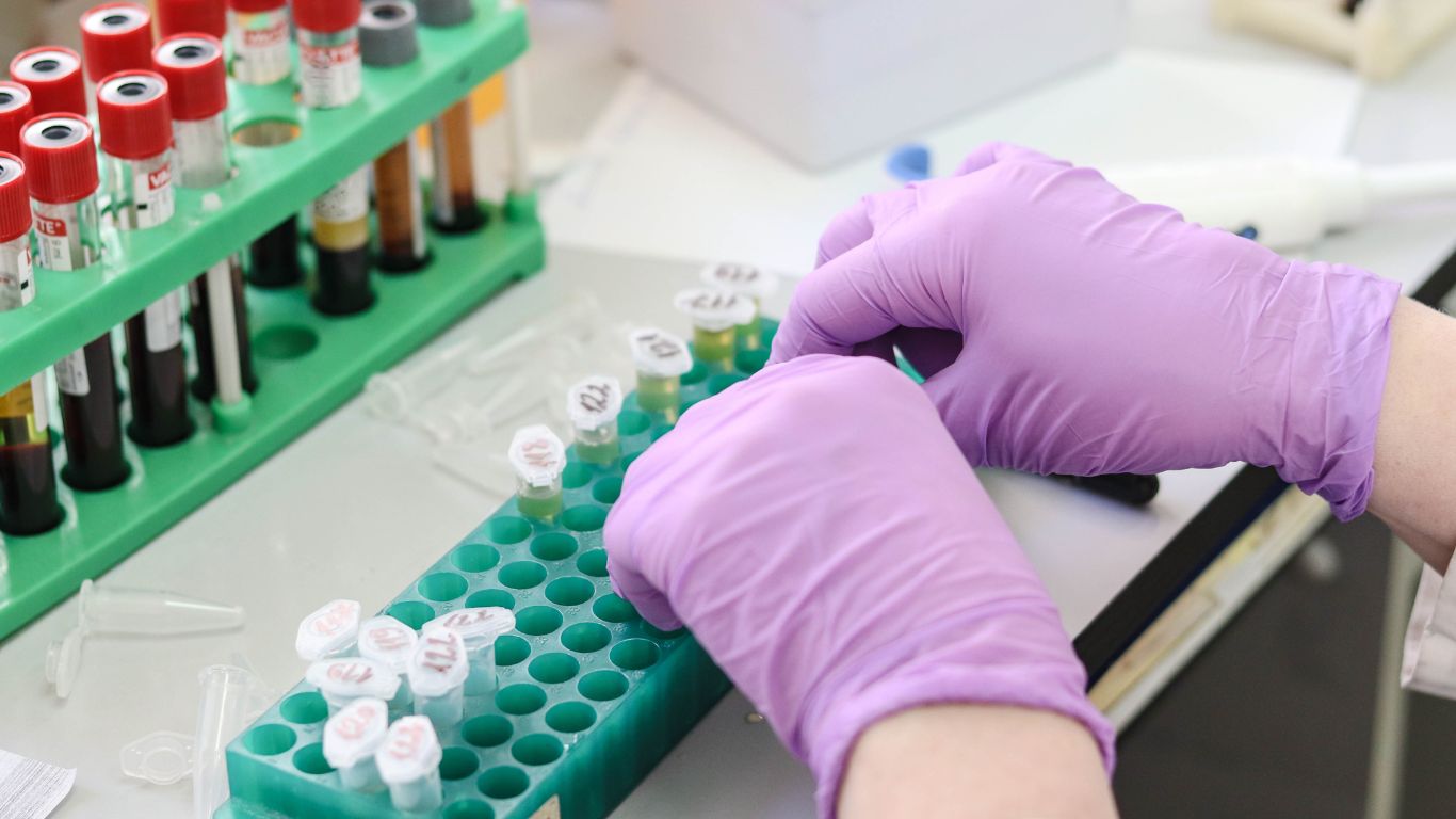 mien-dich-qua-trung-gian-te-bao-la-gi 4