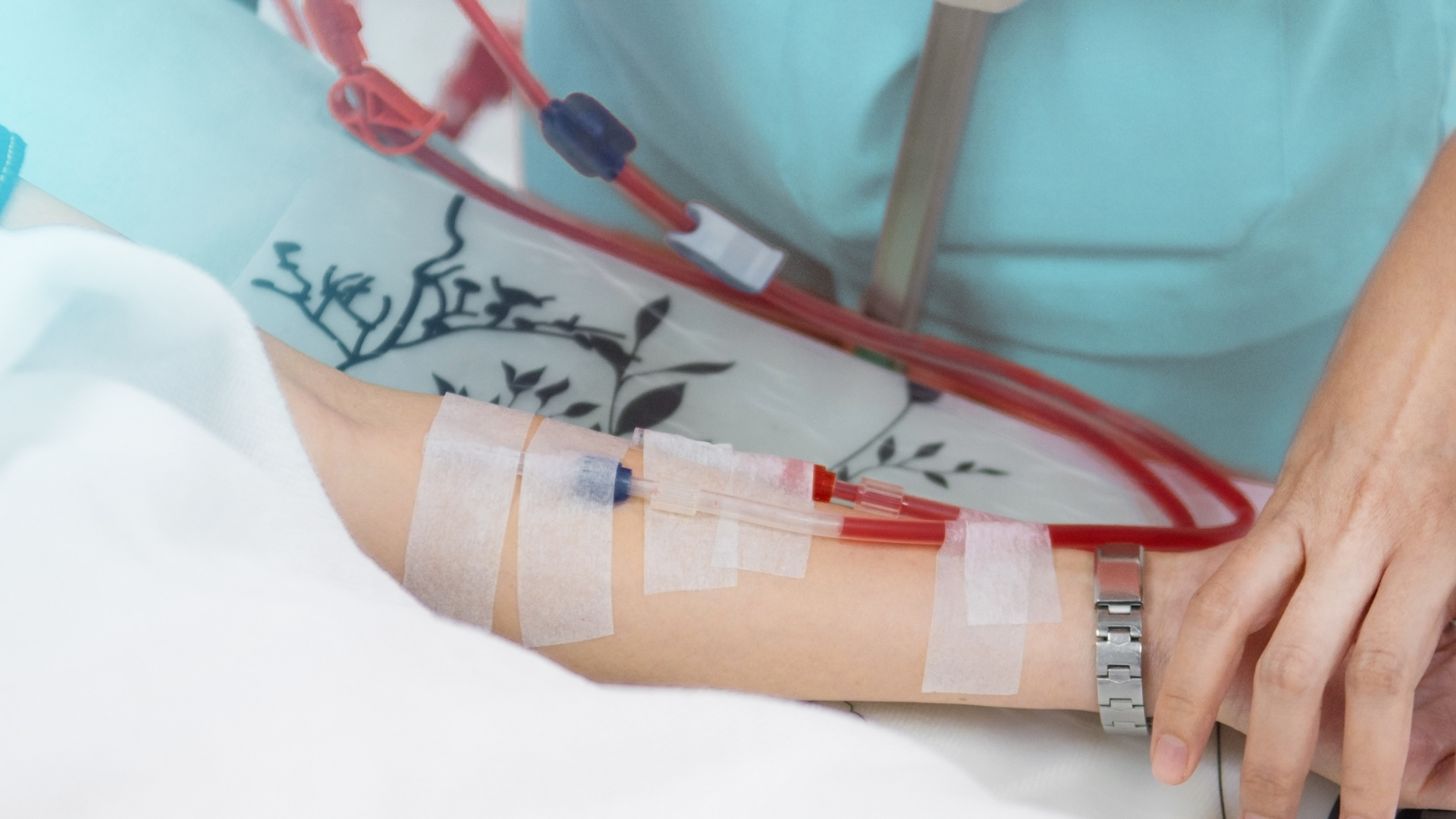 Mổ đặt ống chạy thận nhân tạo: Quy trình, lưu ý và những điều cần chuẩn bị 3