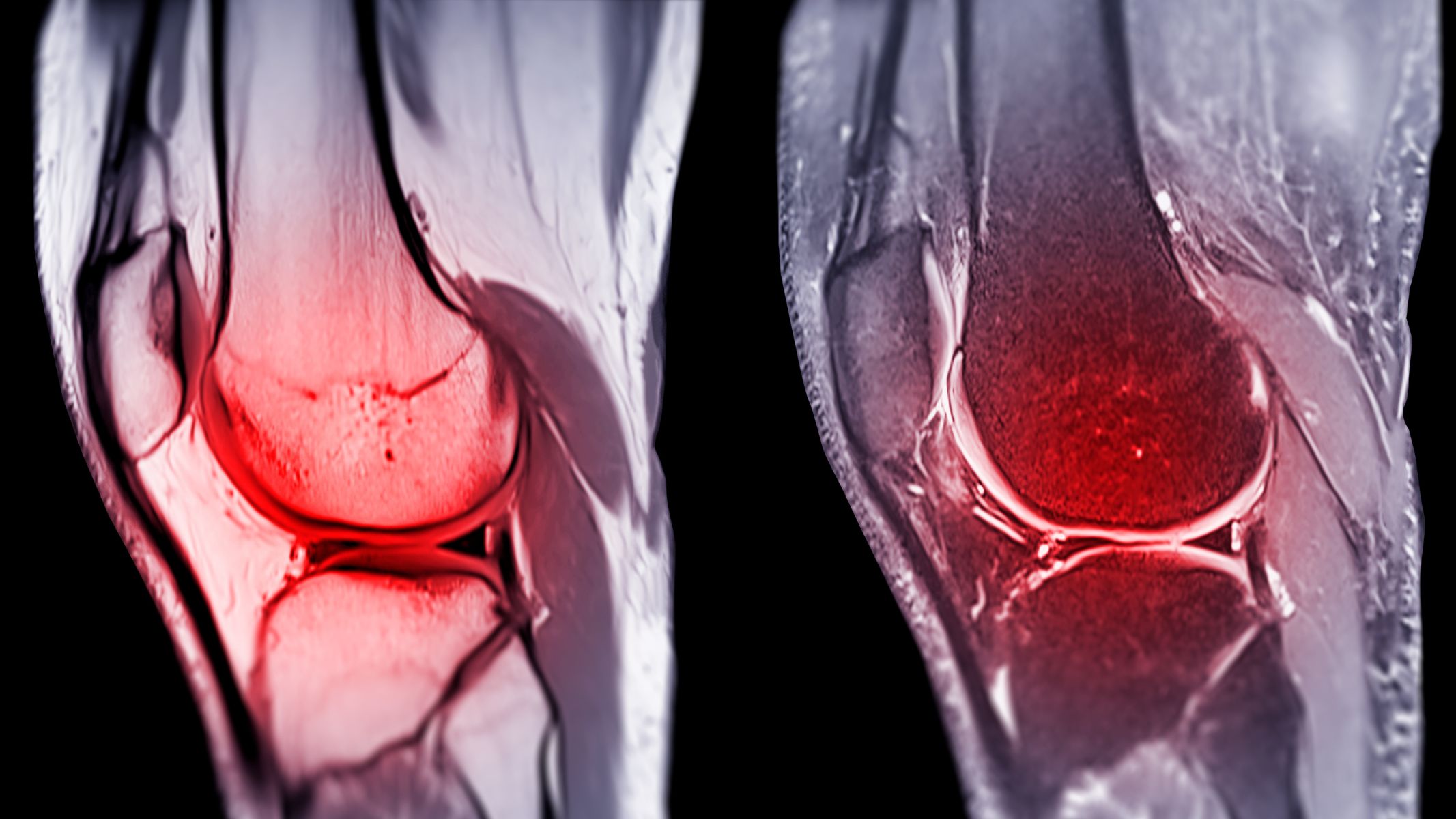 Sau phẫu thuật, cơ thể sẽ tạo phản ứng viêm để bắt đầu sửa chữa mô bị tổn thương