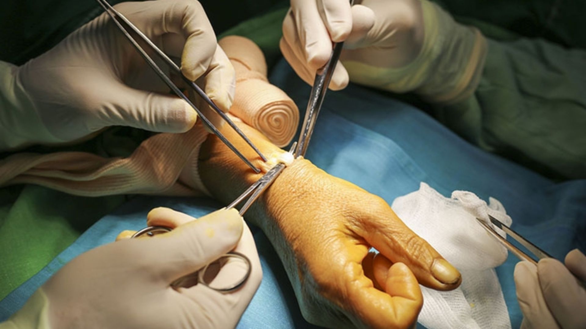 Phương pháp phẫu thuật là một trong các yếu tố quyết định thời gian hồi phục sau mổ