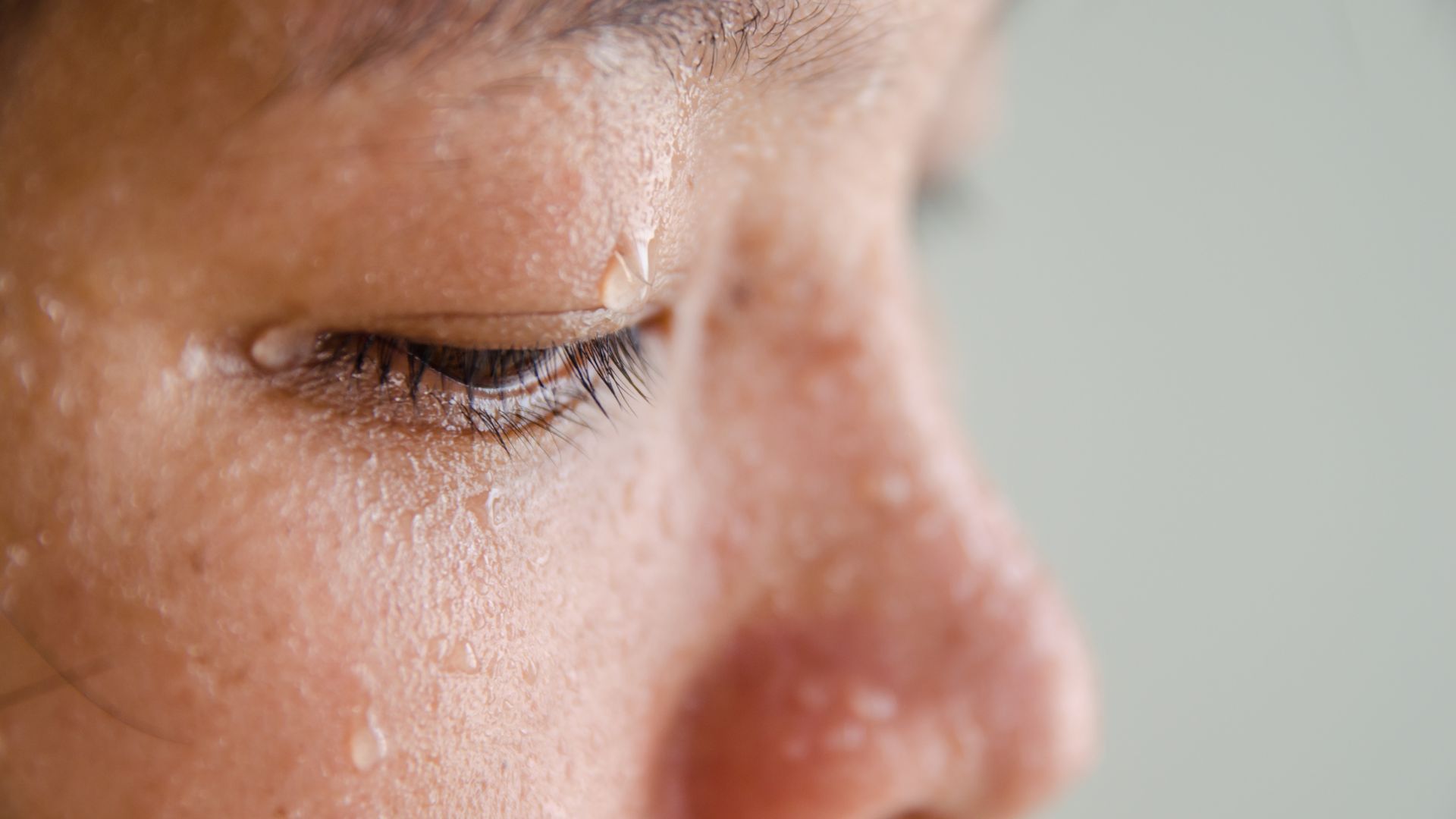 Người có tiền sử gia đình da dầu dễ gặp tình trạng mồ hôi dầu hơn