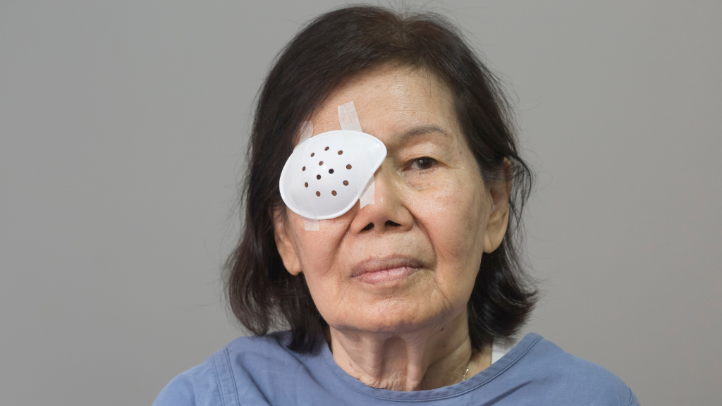 Trong 24 giờ đầu, bạn nên giữ băng mắt liên tục để bảo vệ vết mổ