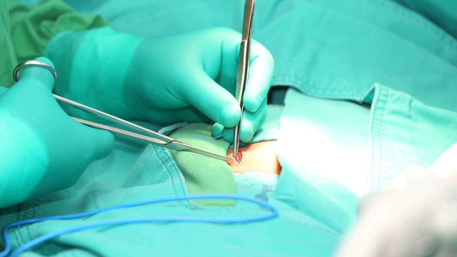 Mổ nội soi ít xâm lấn, phục hồi nhanh hơn so với mổ mở