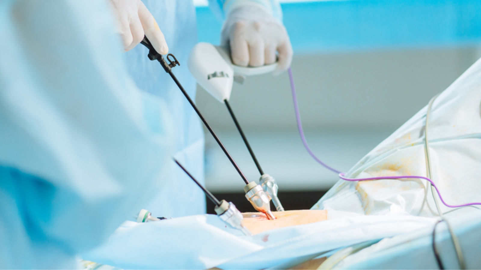 Mổ nội soi khớp gối là kỹ thuật phẫu thuật tiên tiến giúp điều trị tổn thương bên trong khớp