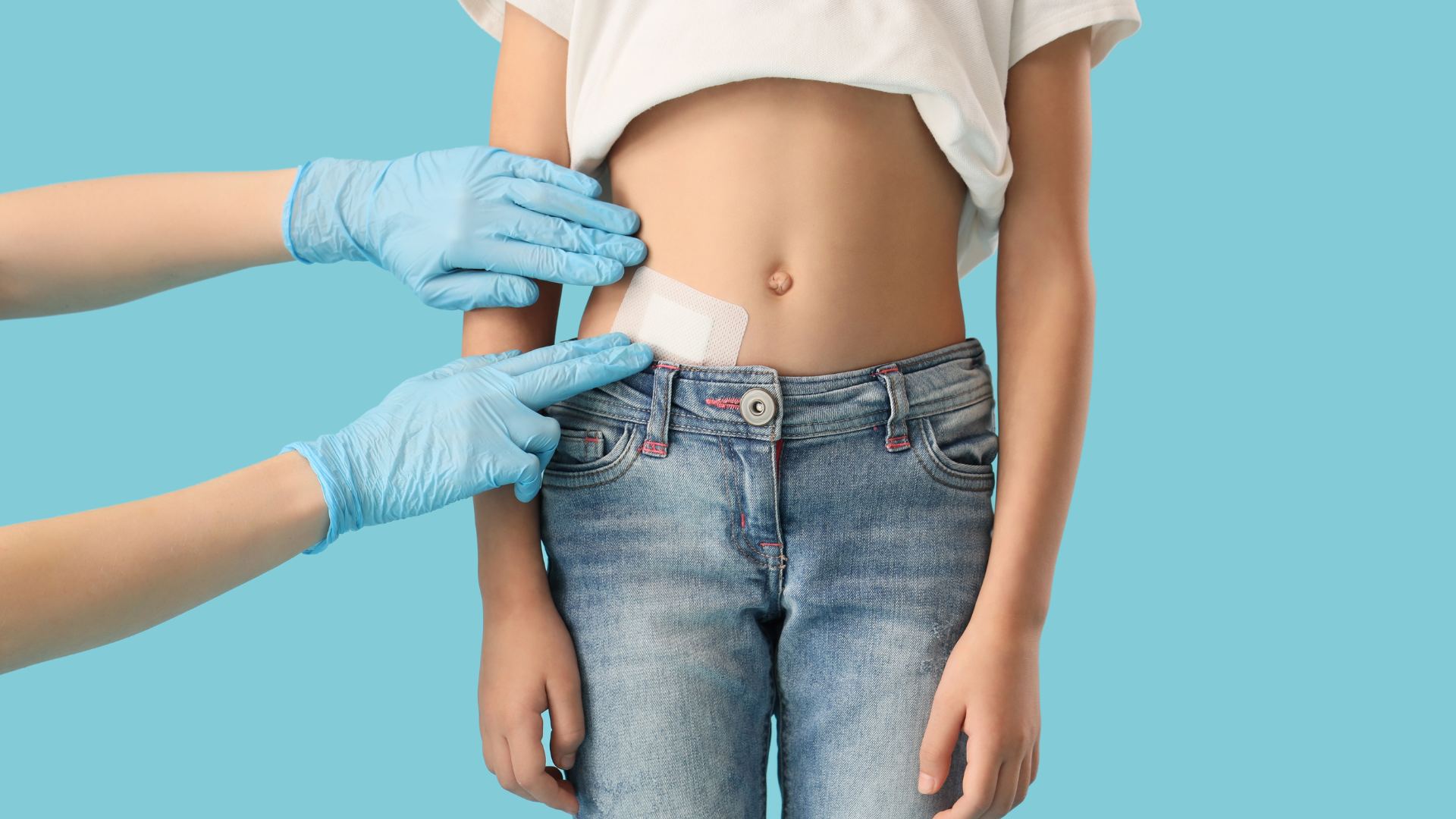 Dấu hiệu viêm ruột thừa cần mổ sớm để tránh biến chứng nguy hiểm