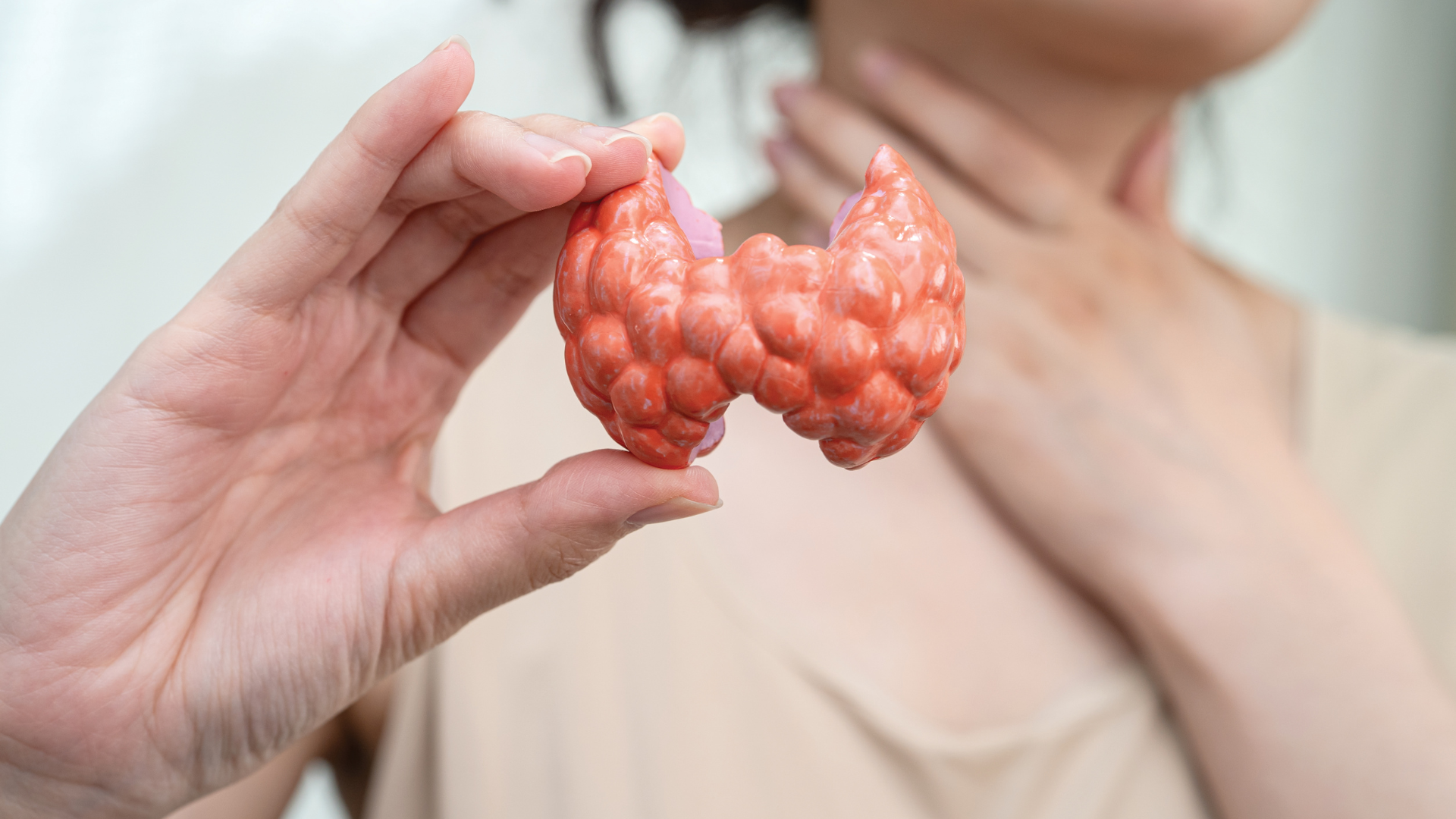 Móng tay bị sọc đen có thể do sinh lý, cũng có thể liên quan bệnh tuyến giáp