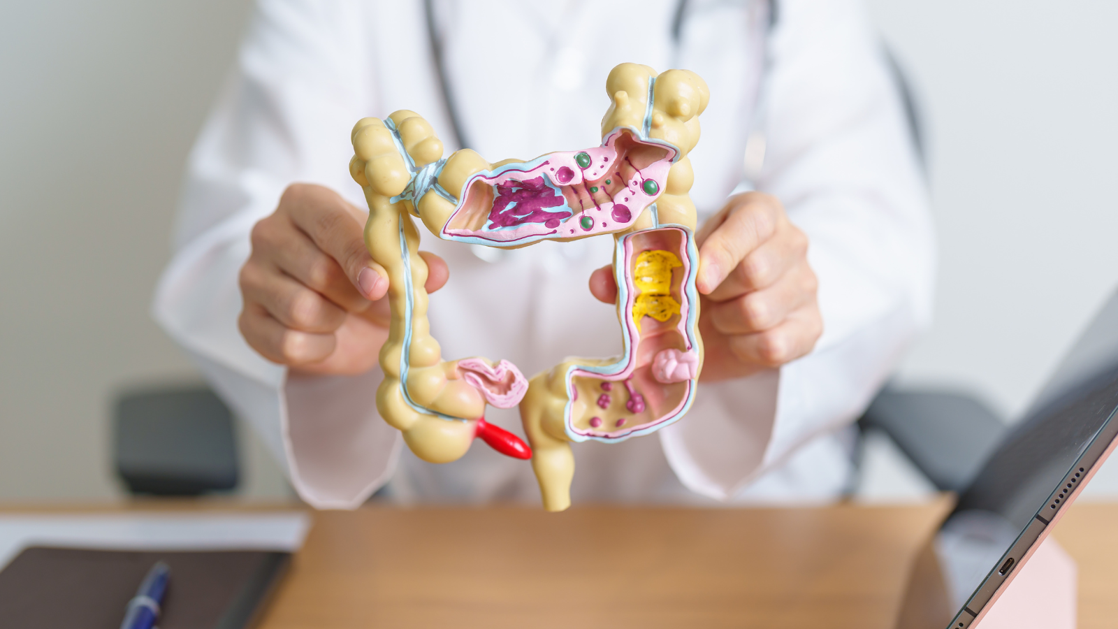 Polyp và ung thư đại trực tràng