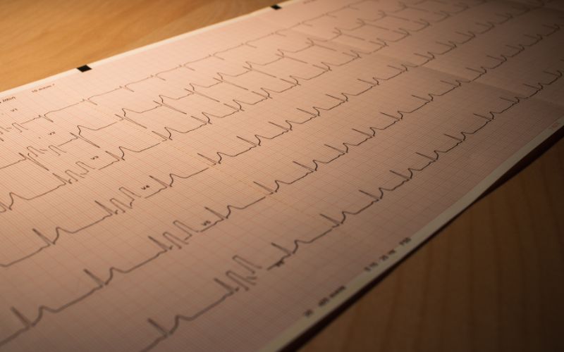 Rối loạn nhịp tim là một trong các biến chứng tim mạch do cúm