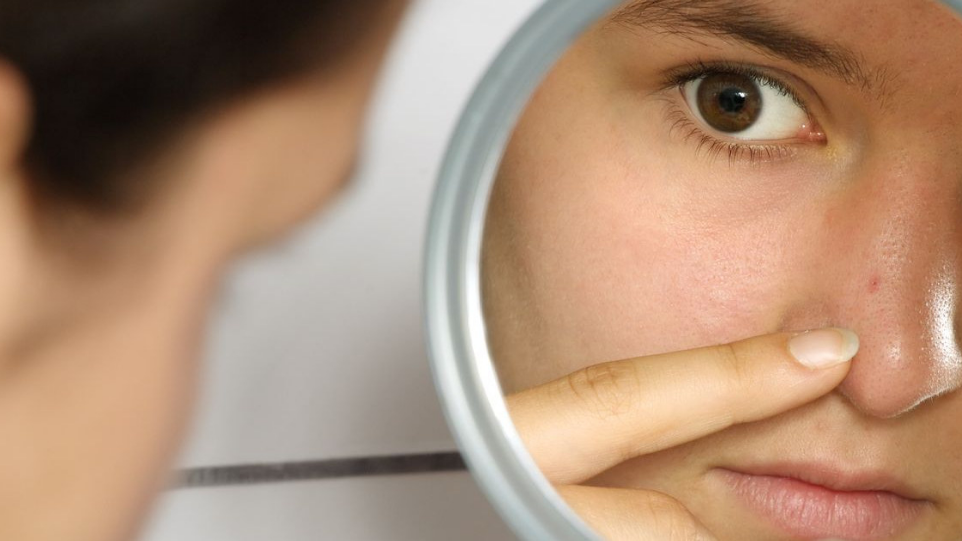 Mụn bọc ở mũi thường cứng khi chạm, nằm sâu dưới da, dễ phân biệt và cần xử lý sớm