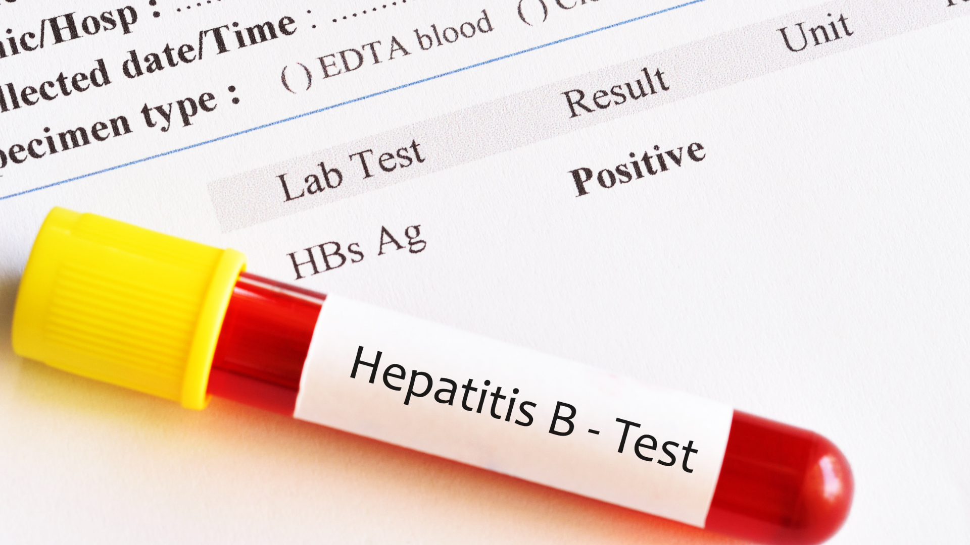 Người trưởng thành nên xét nghiệm HBsAg ít nhất một lần trong đời để biết mình có mang virus hay không