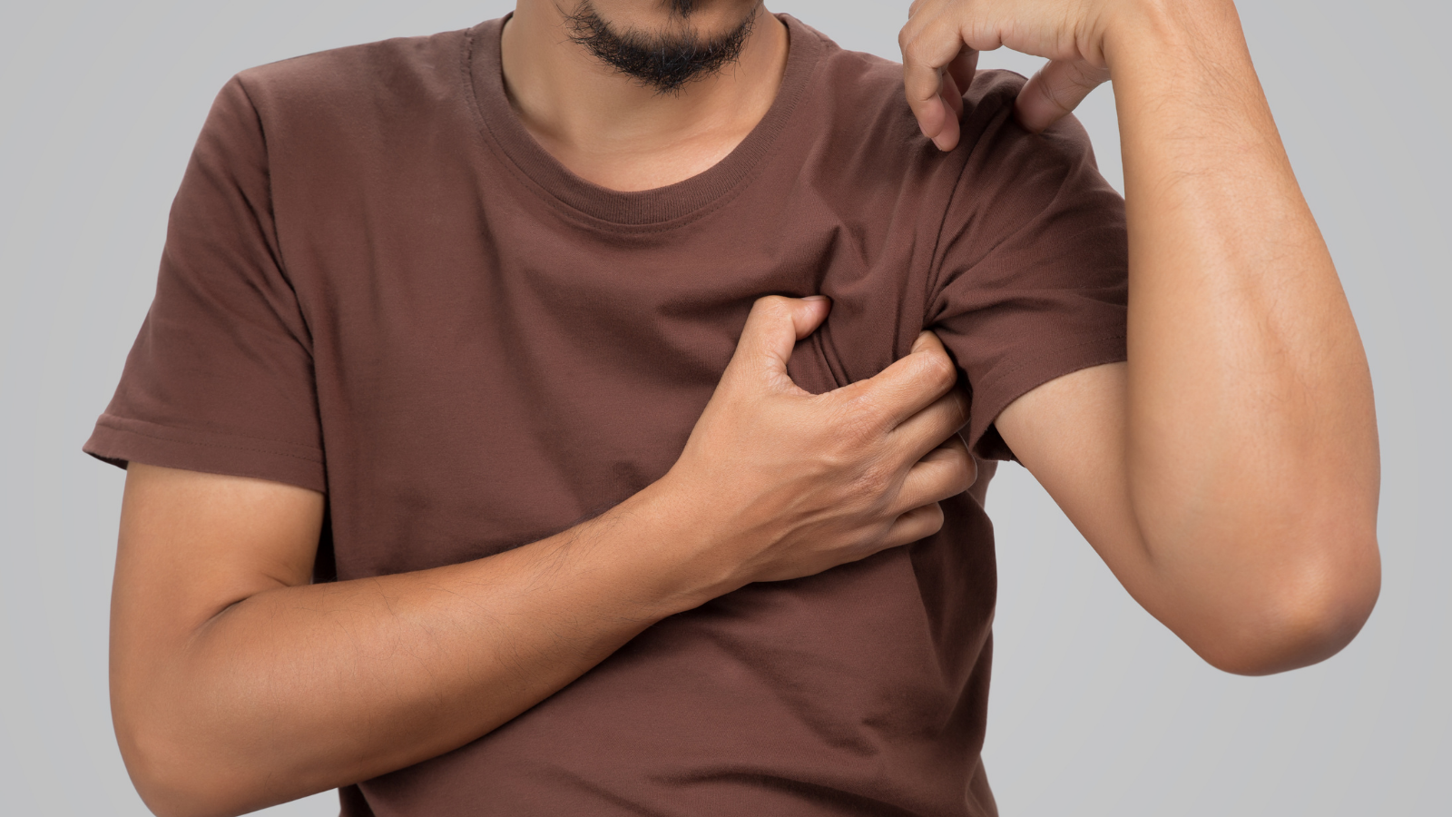 Nách bị ngứa có thể do viêm da, kích ứng hoặc nhiễm nấm vùng nách