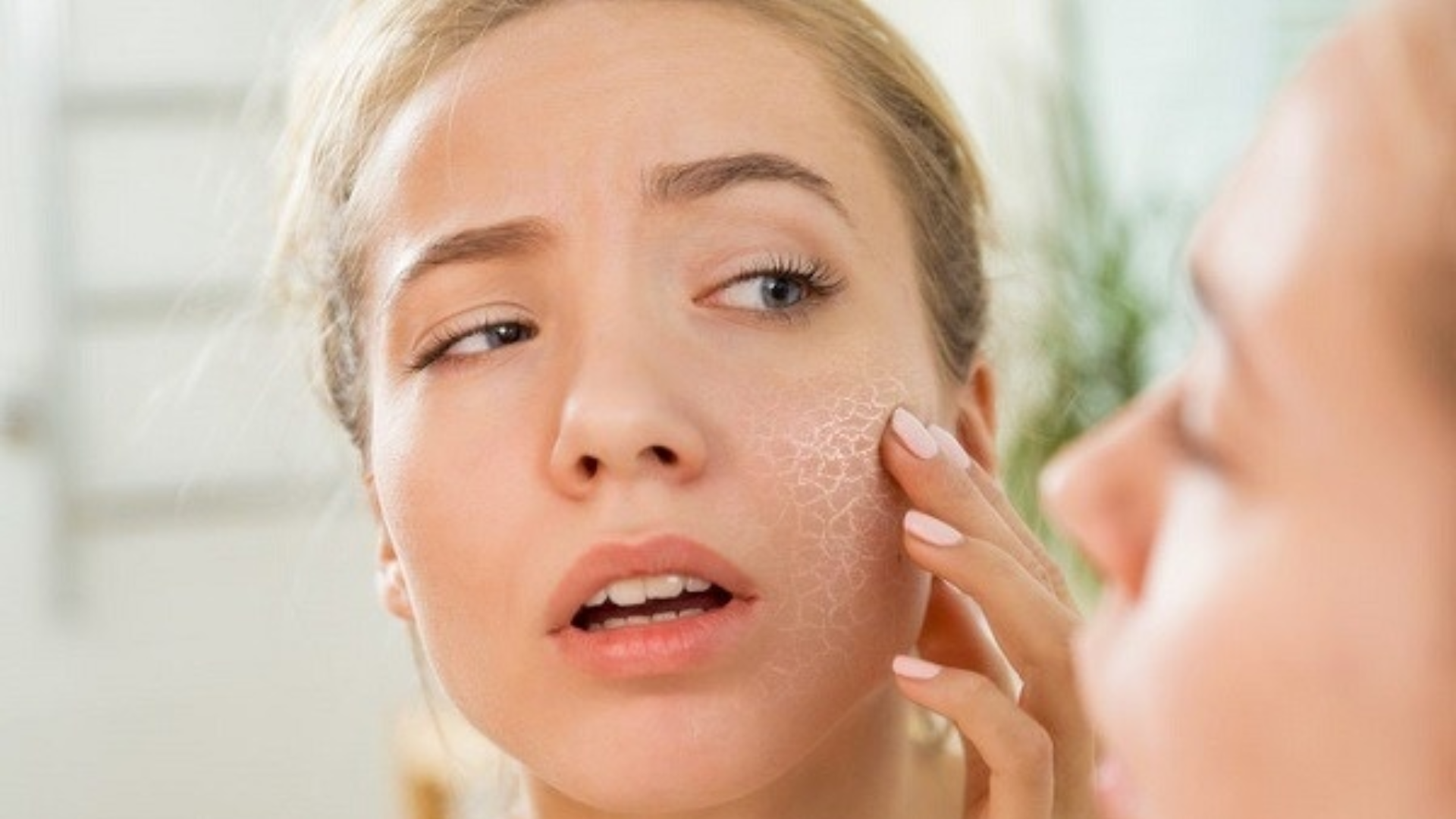 Nấm da mặt thường xuất hiện dễ thấy ở má, vùng quanh mũi và vùng chân tóc