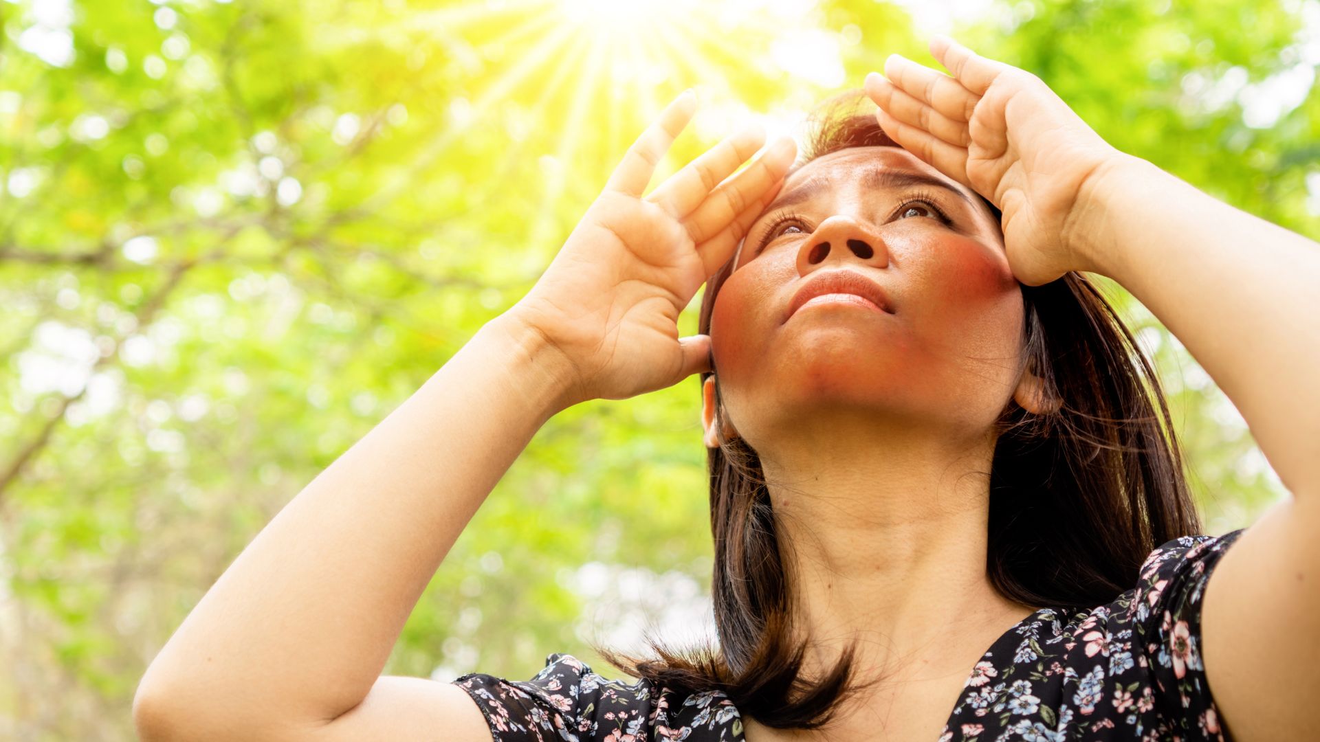 Ánh nắng mặt trời là một trong những nguyên nhân phổ biến gây nám mảng