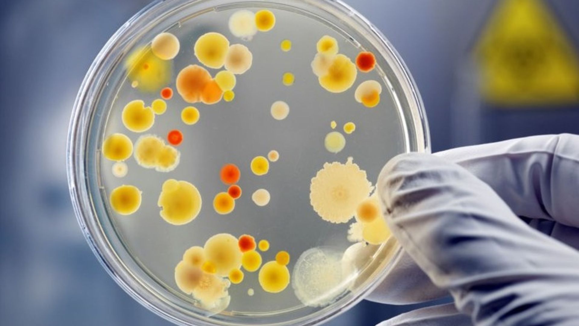 Nấm men là gì vẫn luôn là chủ đề được nhiều độc giả quan tâm