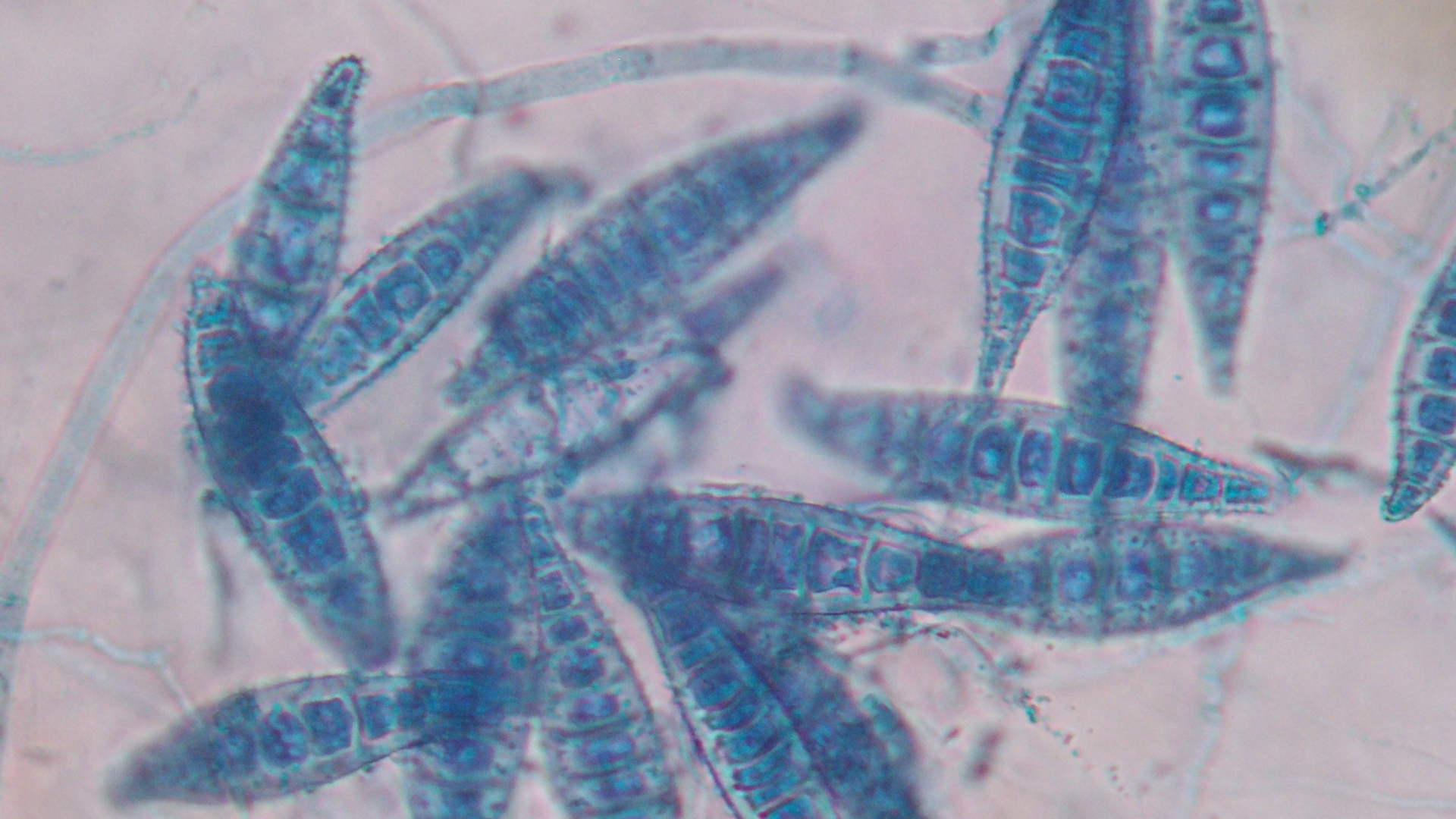Nấm Microsporum là một nhóm vi nấm gây bệnh ngoài da, thường tấn công lớp sừng của da, tóc và lông