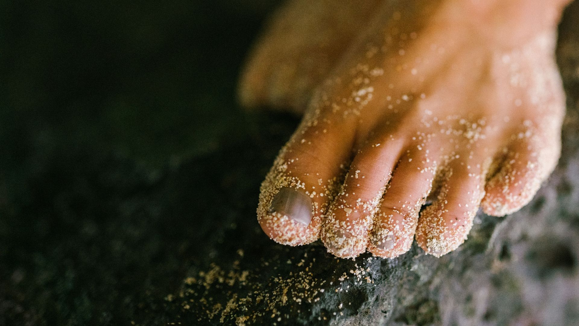 Triệu chứng phổ biến nhất của nấm móng chân là móng thay đổi màu sắc (vàng, trắng, nâu, hoặc đen)