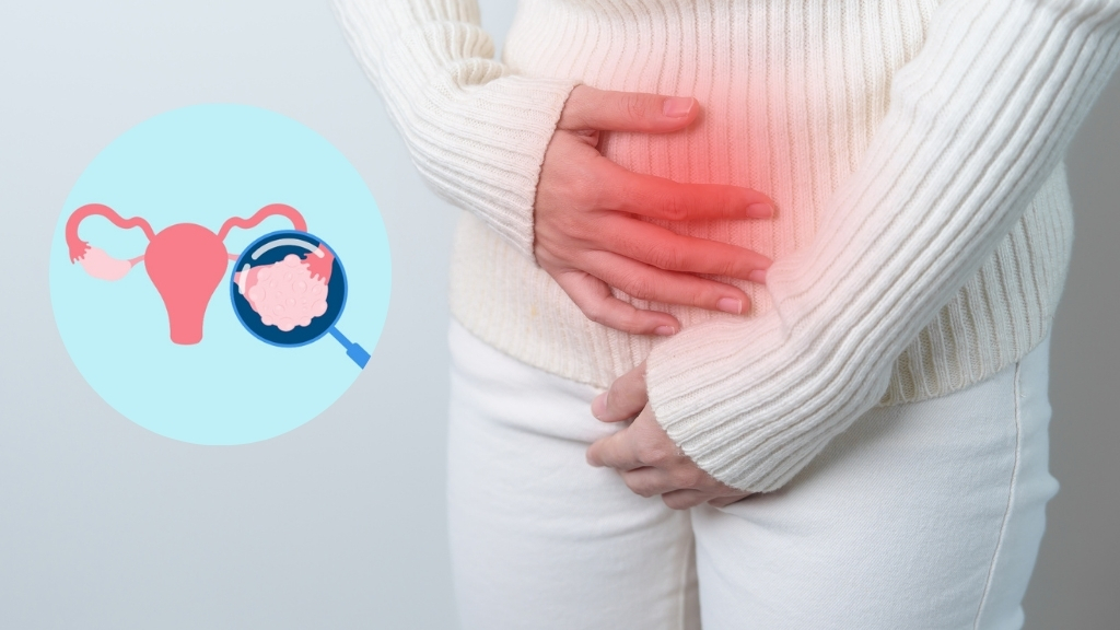 Nang buồng trứng trái: Nguyên nhân, dấu hiệu và mức độ nguy hiểm bạn cần biết 1