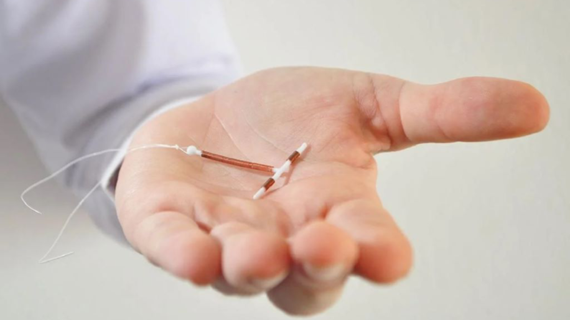 Đặt vòng tránh thai có thể gây tắc ống tuyến, hình thành nang Naboth