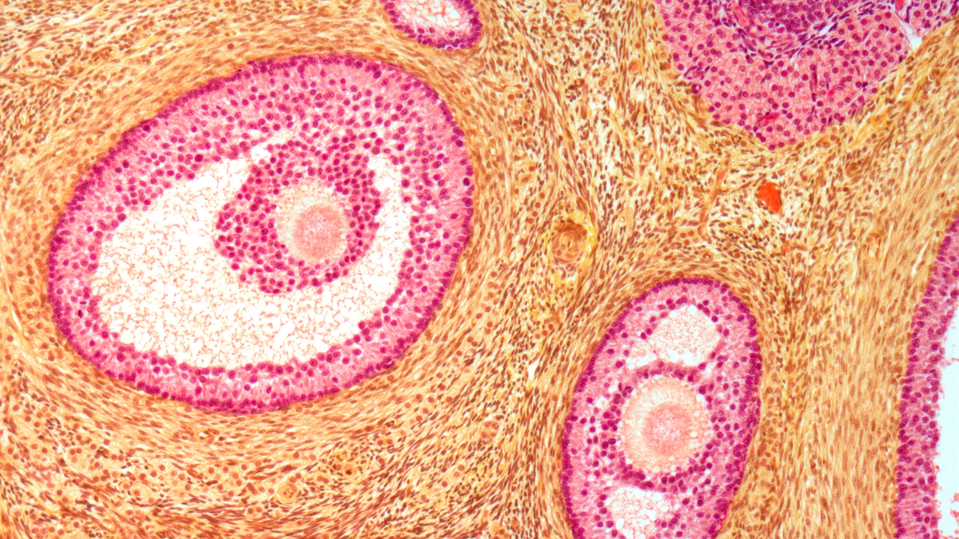 Ở giai đoạn nang trưởng thành, trứng được phóng ra khỏi buồng trứng và sẵn sàng thụ tinh