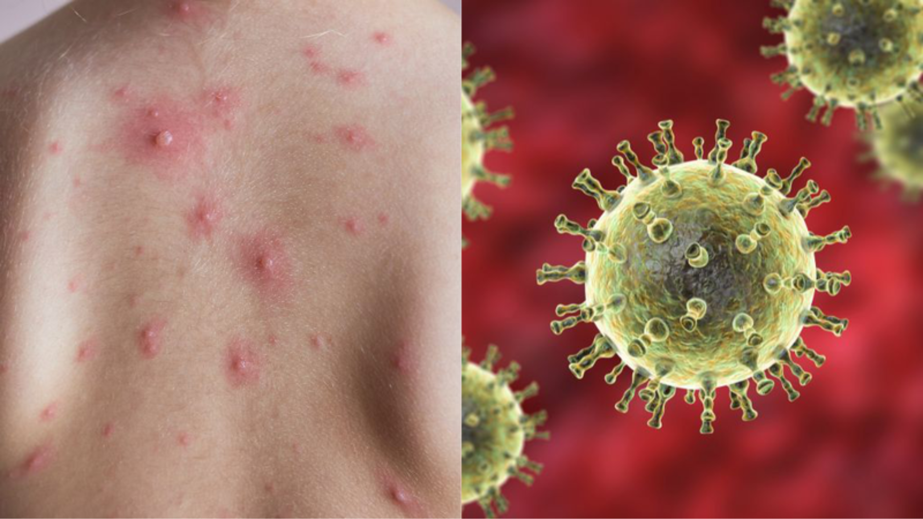 nen-lam-gi-khi-not-thuy-dau-co-mu-bien-phap-phong-thuy-dau-hieu-qua (1).png