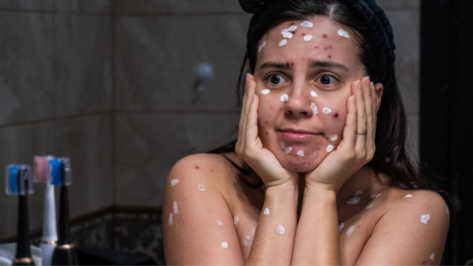 nen-lam-gi-khi-not-thuy-dau-co-mu-bien-phap-phong-thuy-dau-hieu-qua (2).png