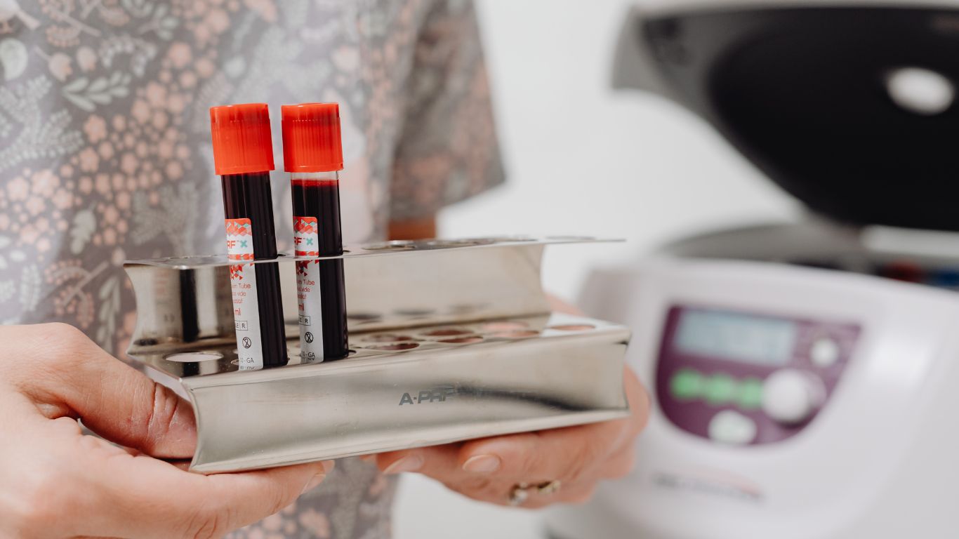 neu-lo-an-sang-co-xet-nghiem-mau-duoc-khong 2