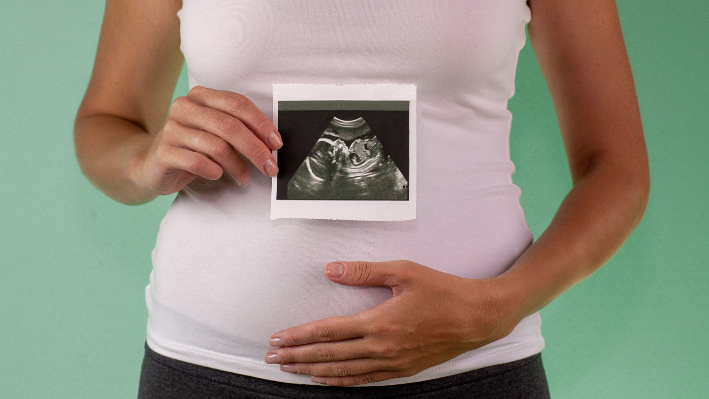Ngải cứu có tác dụng gì? Các lợi ích sức khỏe và những lưu ý quan trọng khi sử dụng 4