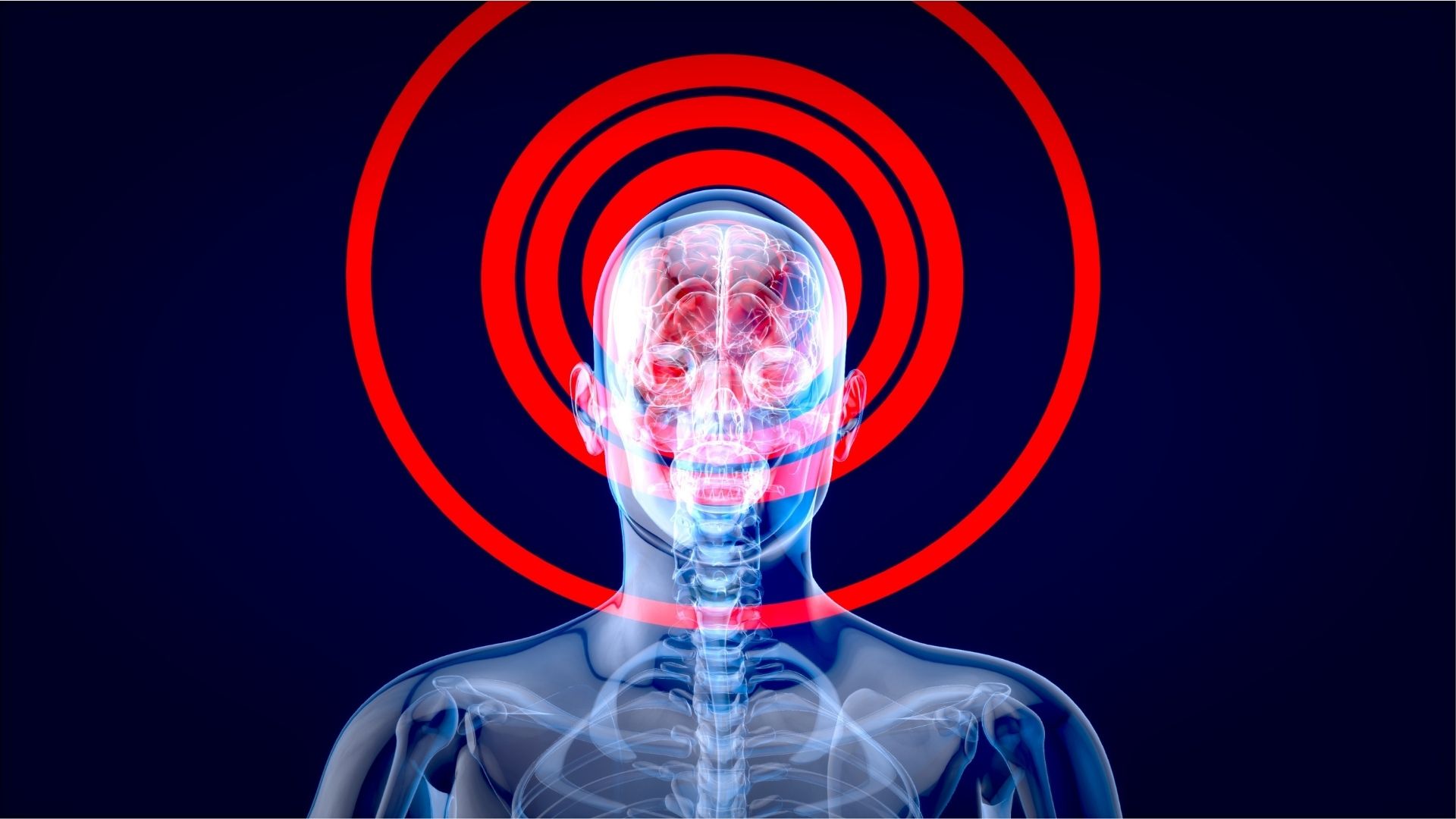 Ngất xỉu tạm thời có thể ảnh hưởng tới hệ tim mạch và não bộ