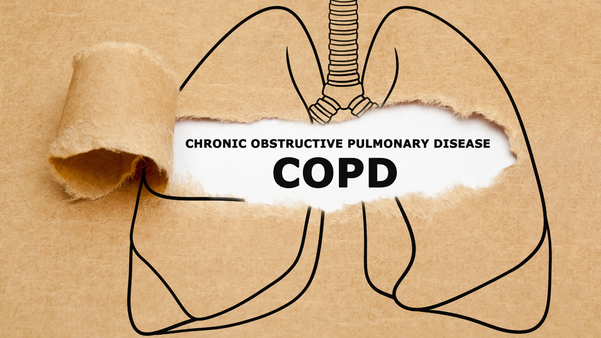 Có thể phát hiện được COPD do sự thay đổi dòng khí và xuất hiện các âm thanh đặc trưng