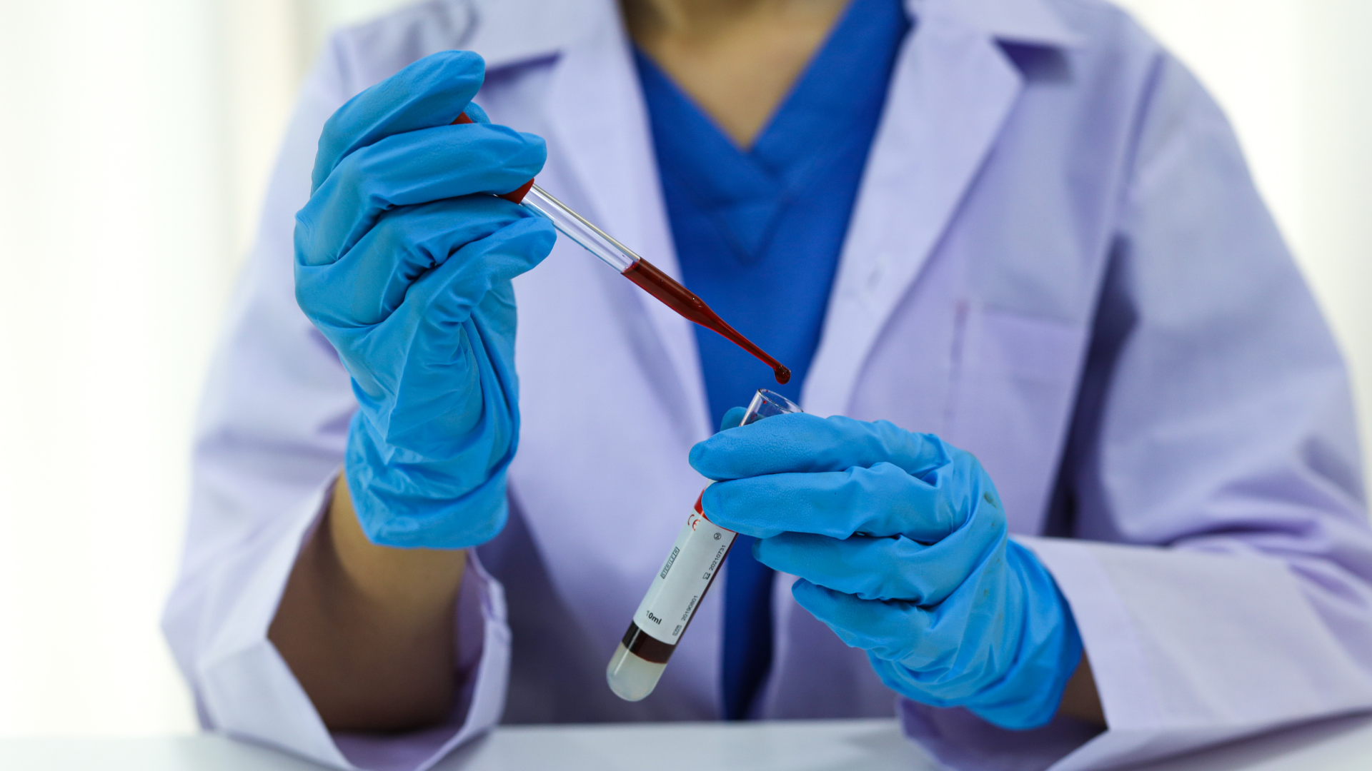 Nghiệm pháp Coombs là công cụ hữu ích giúp phát hiện các rối loạn miễn dịch liên quan đến hồng cầu