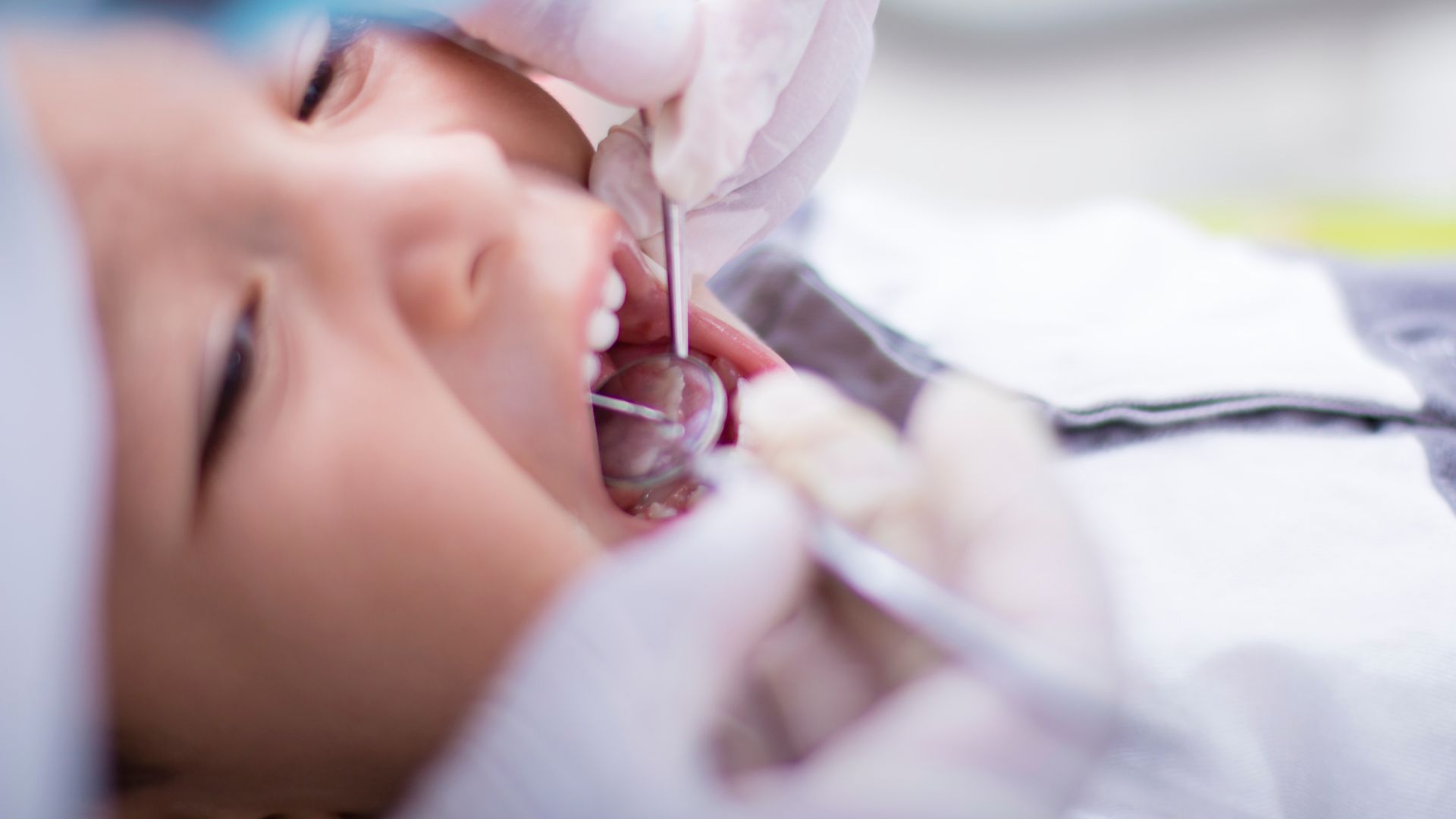 Cha mẹ nên cho trẻ đi khám răng định kỳ để phát hiện sớm các bất thường về răng miệng