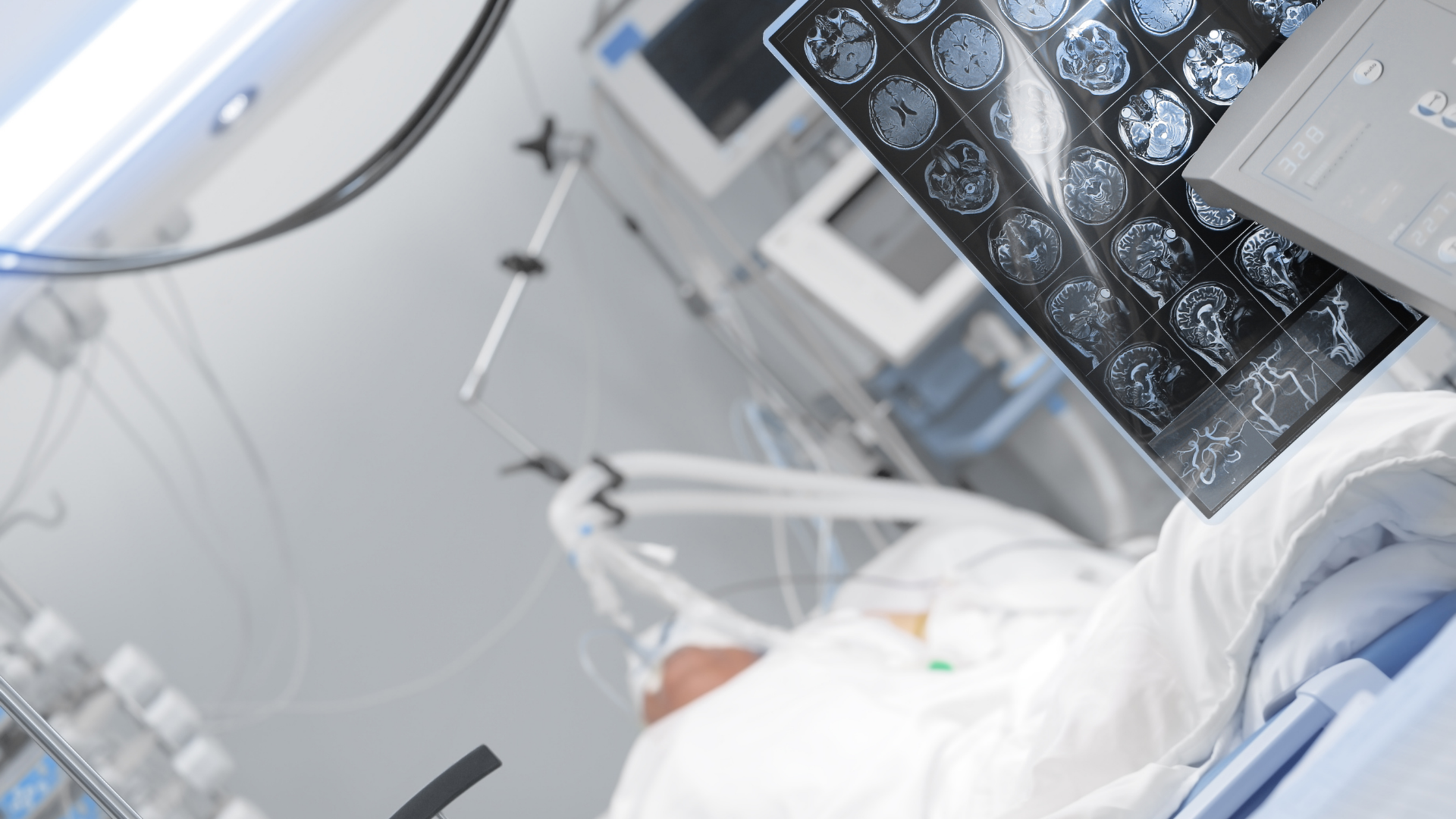 Morphine quá liều có thể ảnh hưởng đến hệ hô hấp và thần kinh