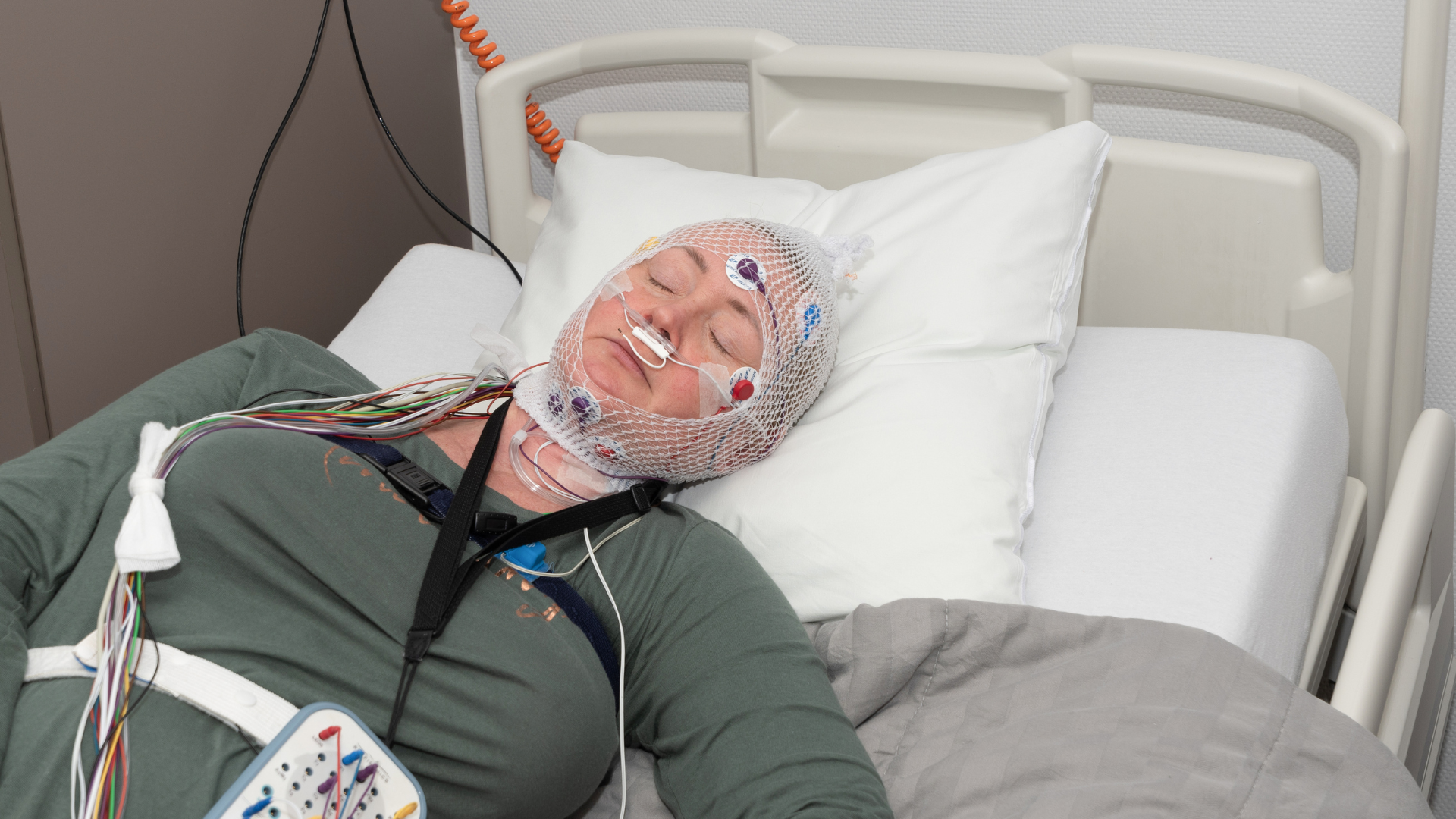 Đo đa ký giấc ngủ hỗ trợ chẩn đoán nguyên nhân ngủ ngáy