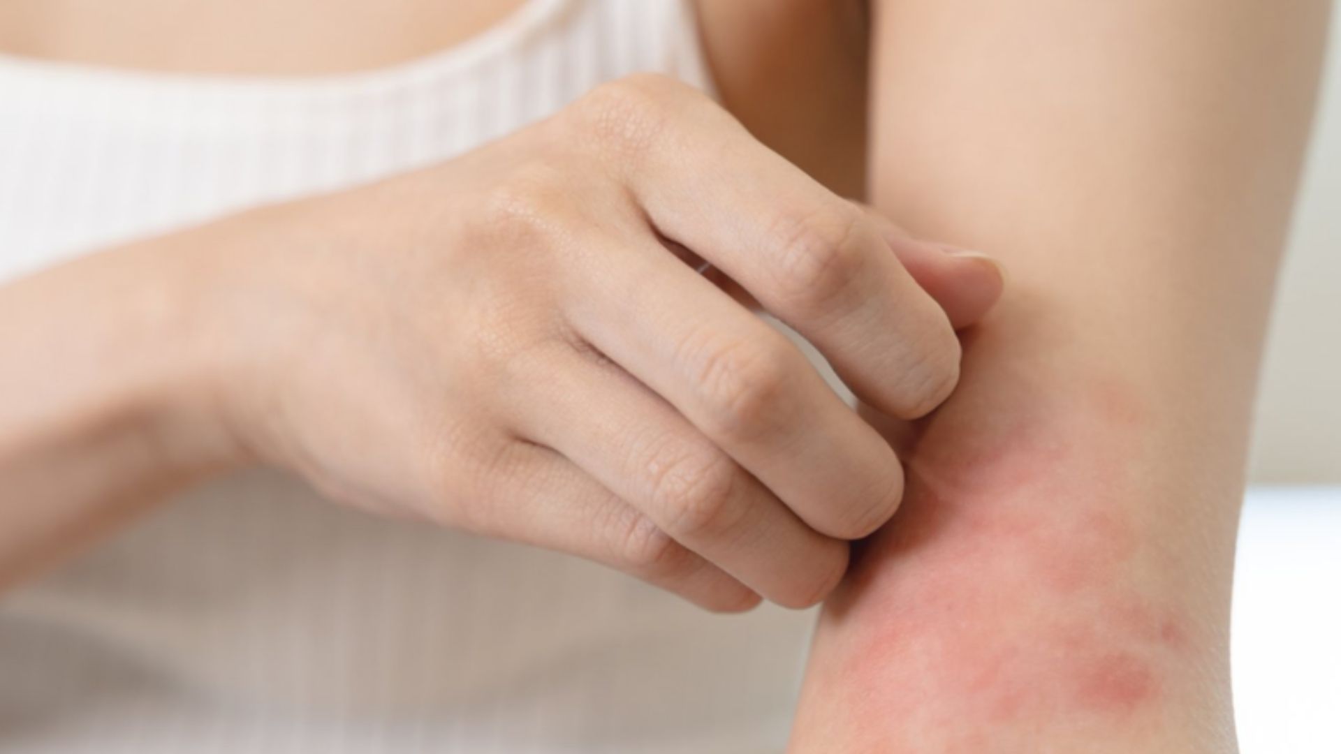 Ngứa liên tục vùng da nào đó có thể là dấu hiệu bị bọ chét cắn