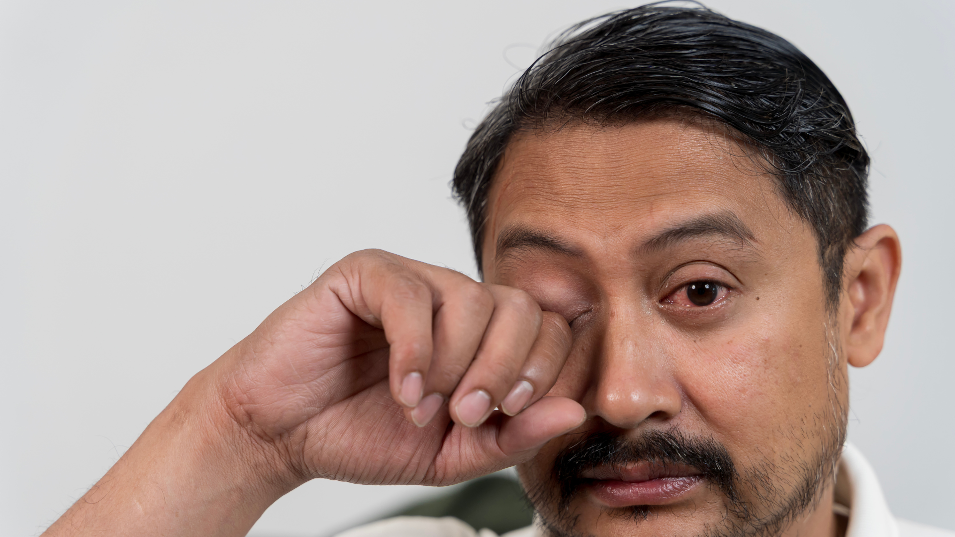 Ngứa mắt trái có nguy hiểm không là thắc mắc của nhiều người