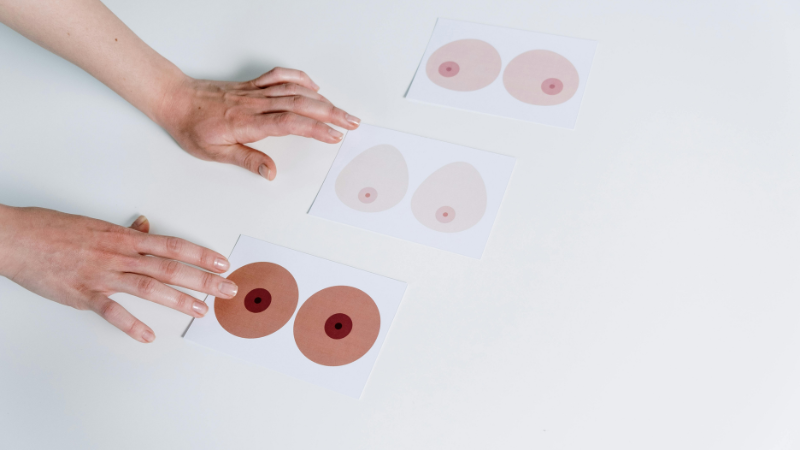 Nhũ hoa trở nên sưng, ngứa và thay đổi màu sắc theo chu kỳ kinh nguyệt