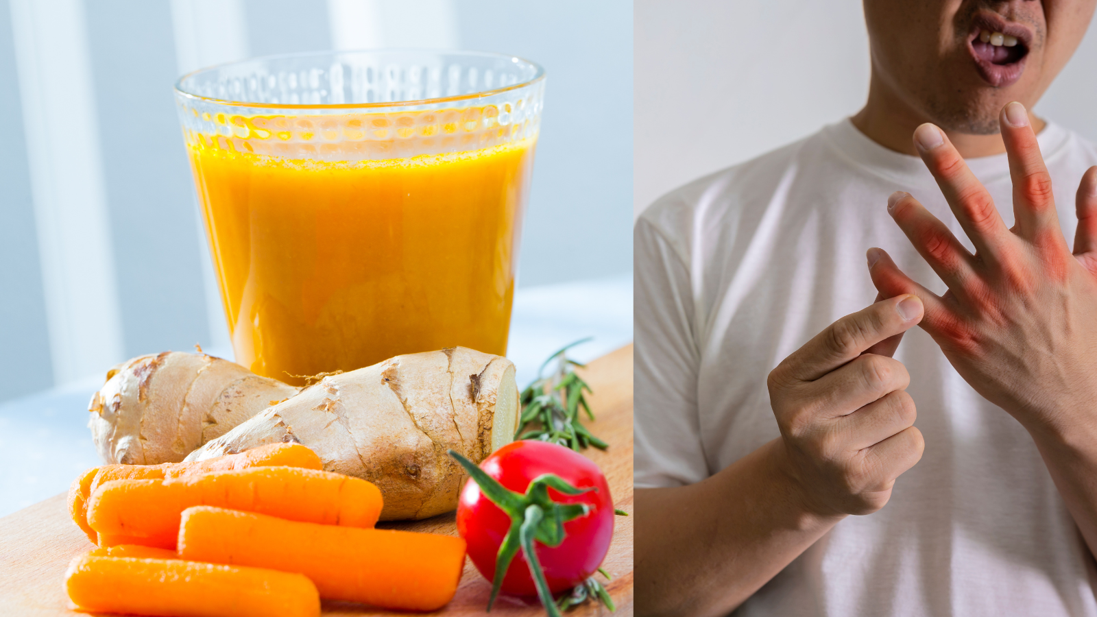 Cà rốt tốt cho người bệnh gút