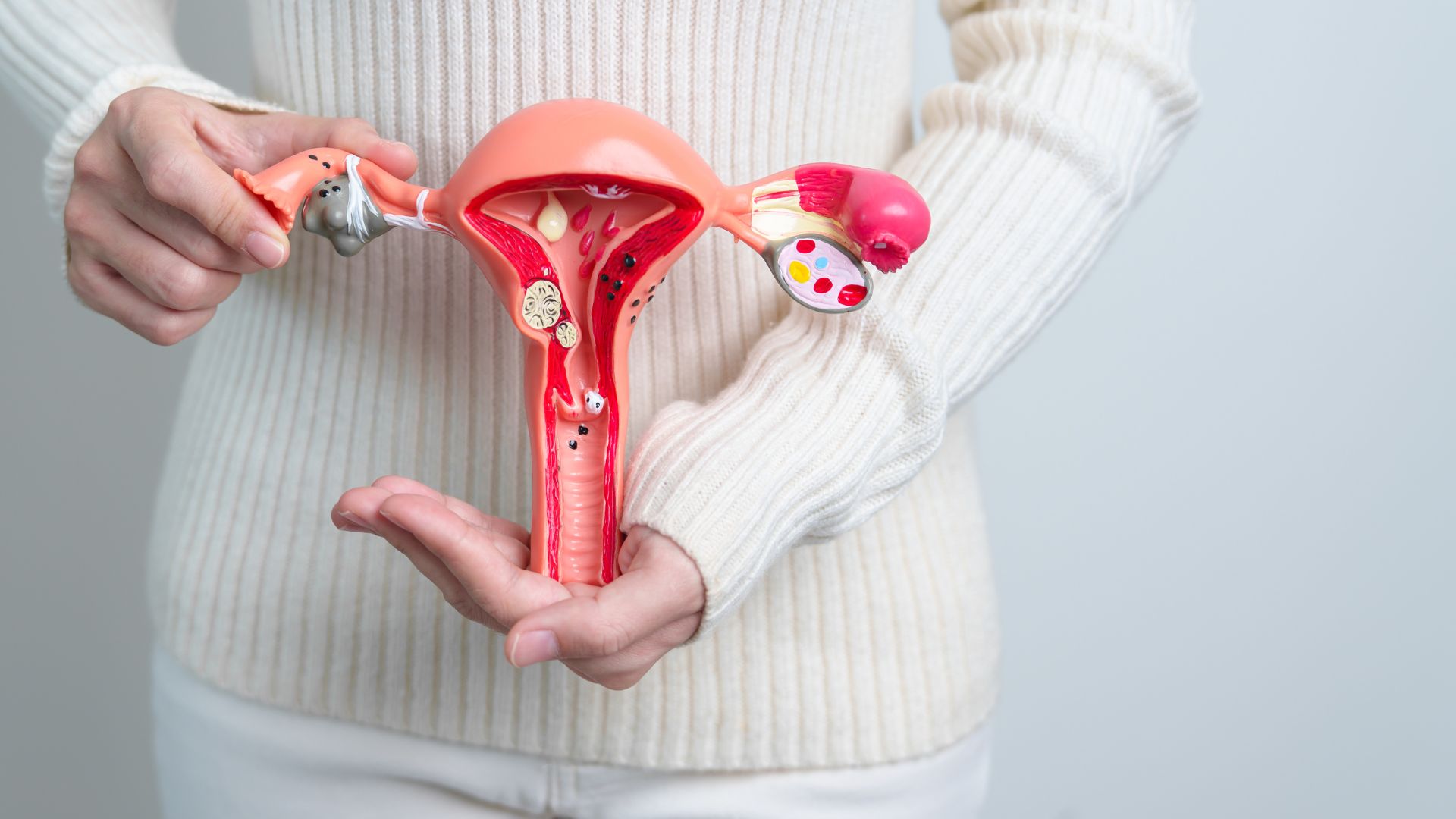 Người bị u xơ tử cung có nên ăn đậu phụ không? Những điều cần biết 1