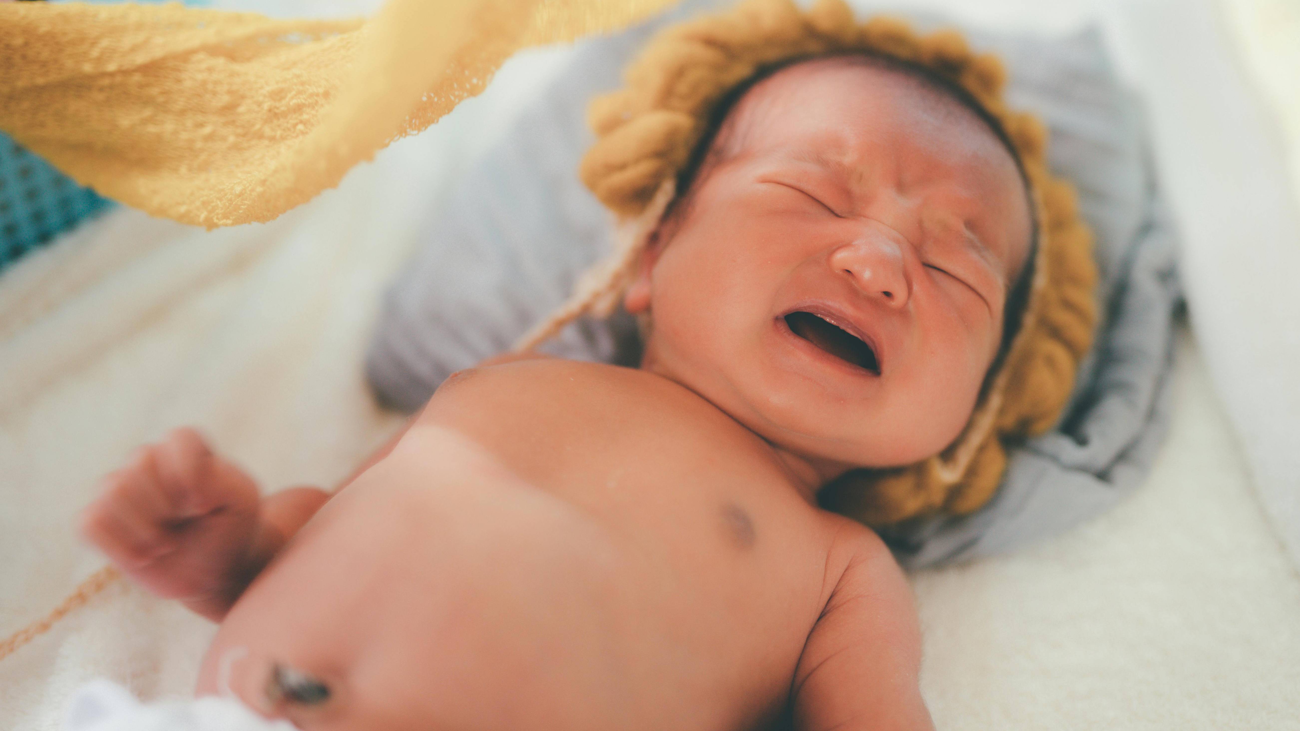 Hăm tã cấp độ 5 khiến bé mệt mỏi, biếng bú, có thể sốt hoặc nổi hạch