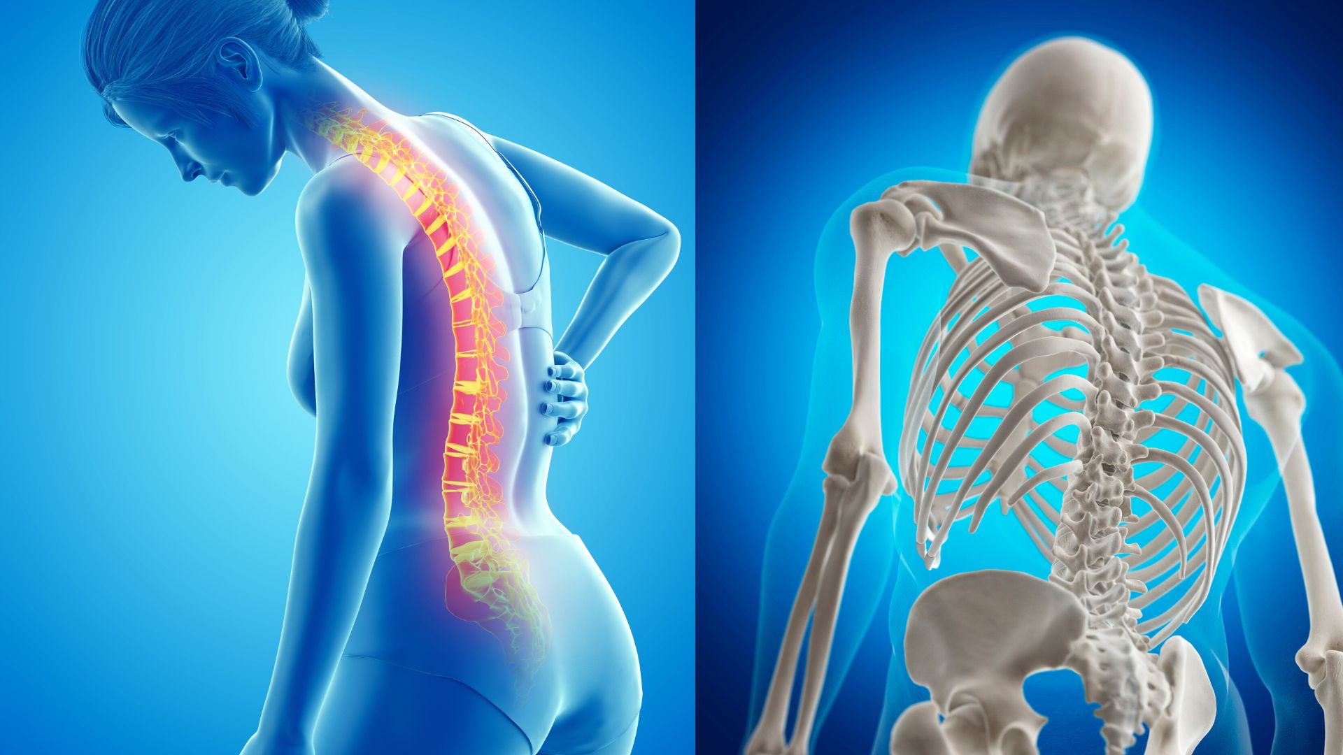 So sánh mật độ xương bình thường và xương loãng