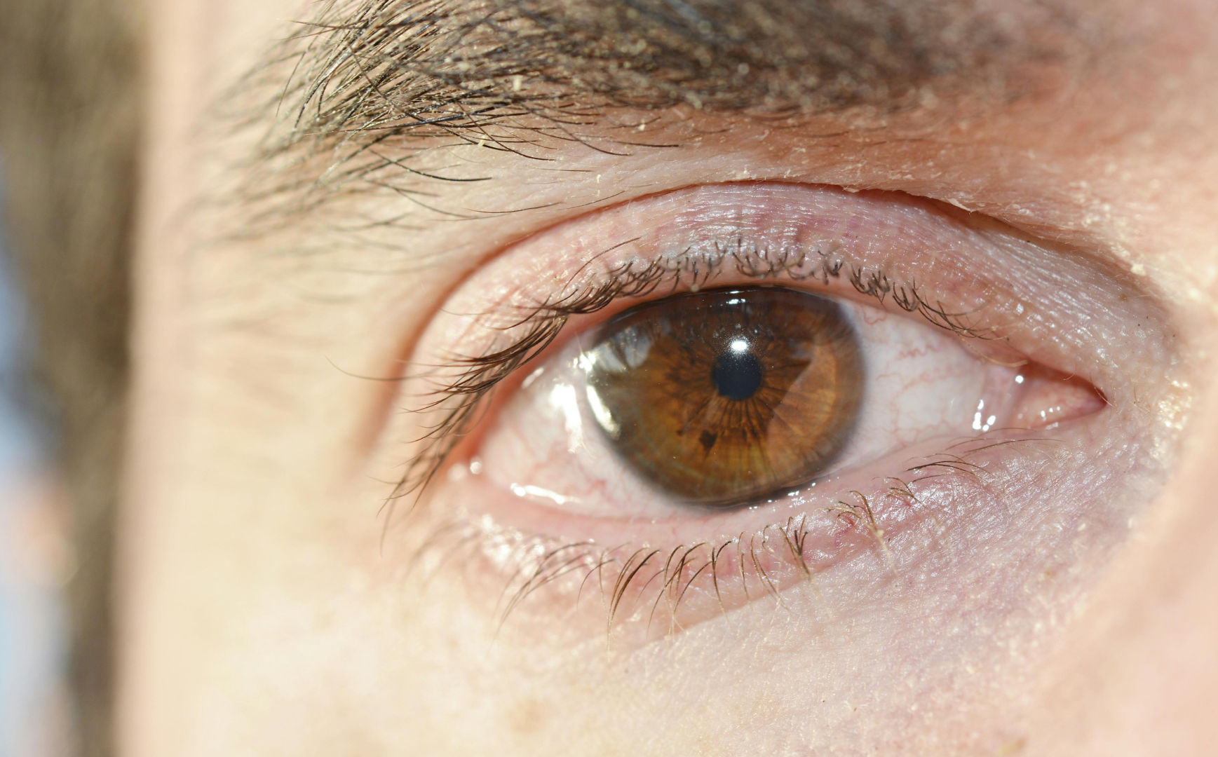 nguyen-nhan-dan-den-mat-bi-do-va-phuong-phap-dieu-tri-khi-bi-do-mat 4.png