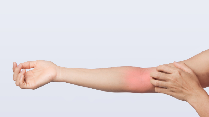 Dị ứng bia khác gì không dung nạp rượu? Phân biệt để xử lý đúng 2