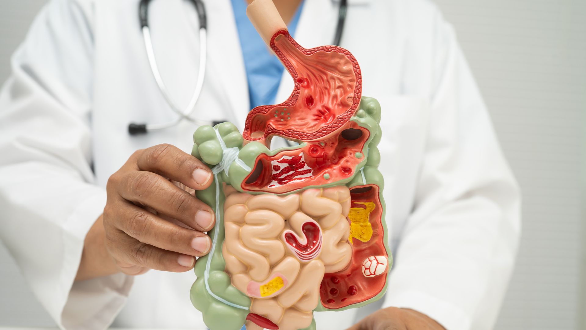 Nguyên nhân gây hôi miệng có thể xuất phát từ hệ tiêu hóa khi dịch từ dạ dày đi ngược lên cổ họng