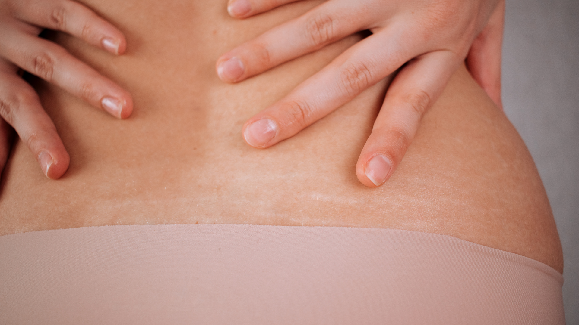 Thời điểm xuất hiện vết rạn ở mỗi người sẽ khác nhau tùy thuộc vào nhiều yếu tố