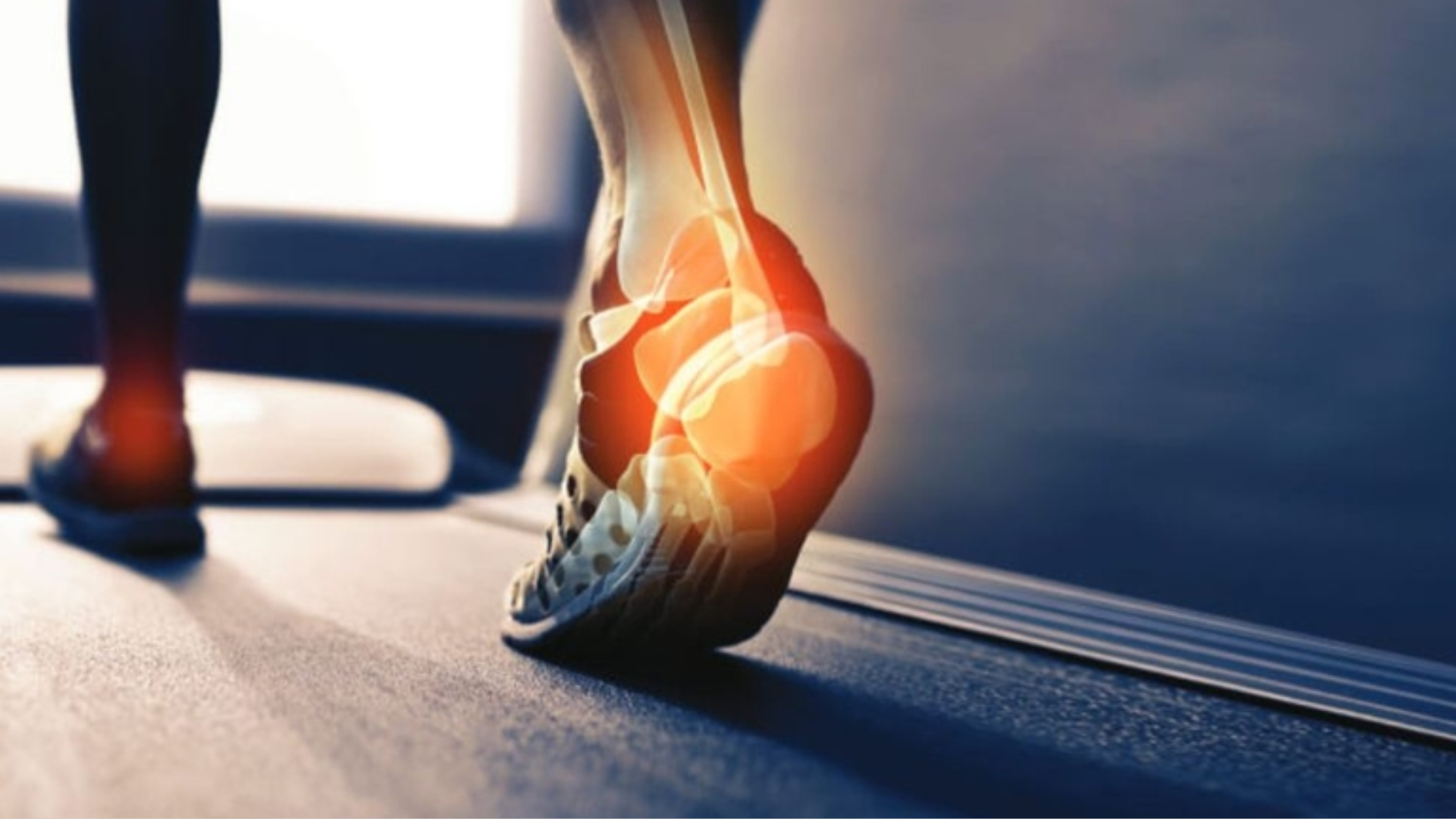 Nứt xương chân xảy ra khi áp lực lên chân lớn