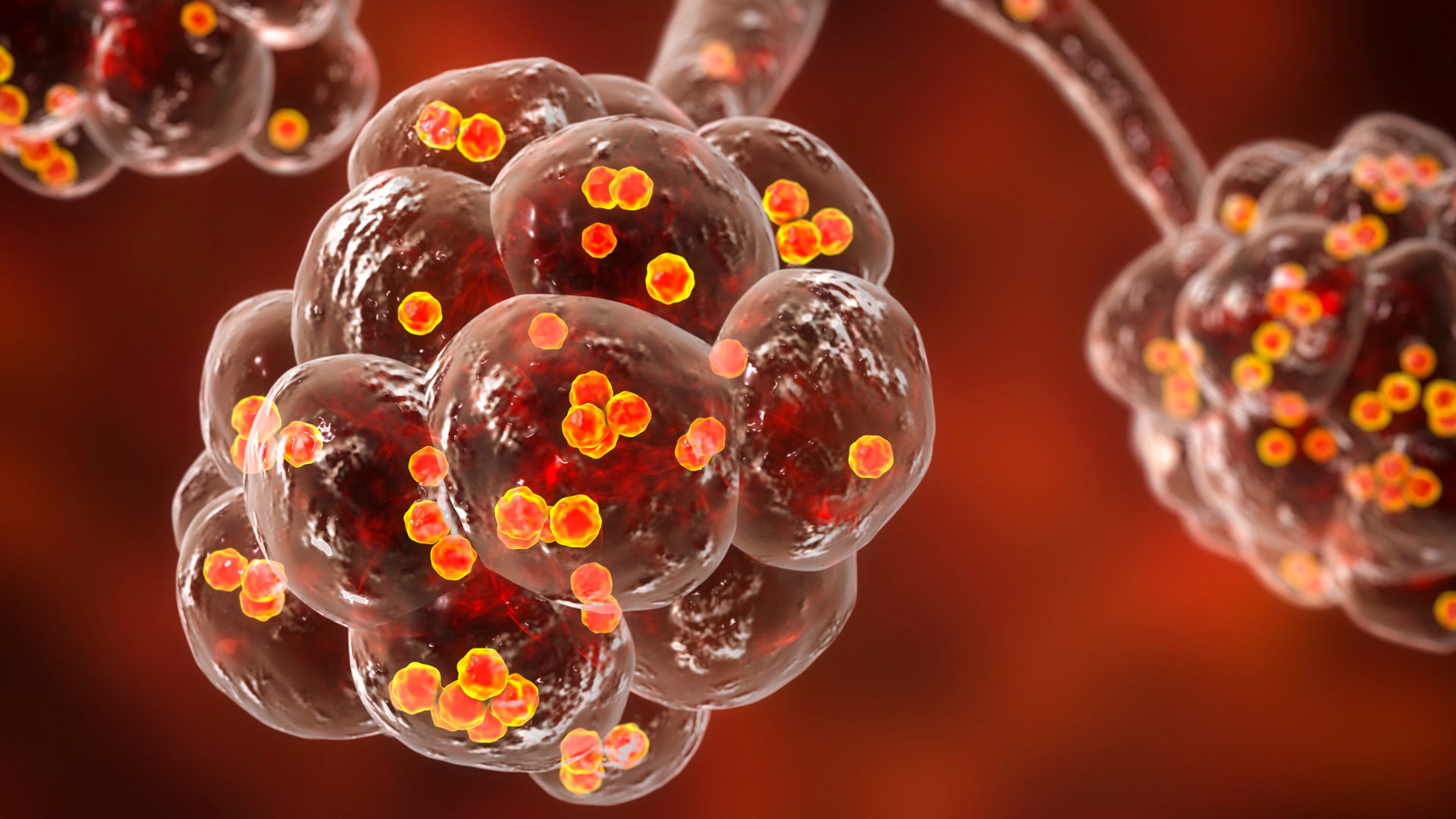 Nhiễm trùng do tụ cầu khuẩn là nguyên nhân gây triệu chứng nổi mụn nước ngứa khắp người