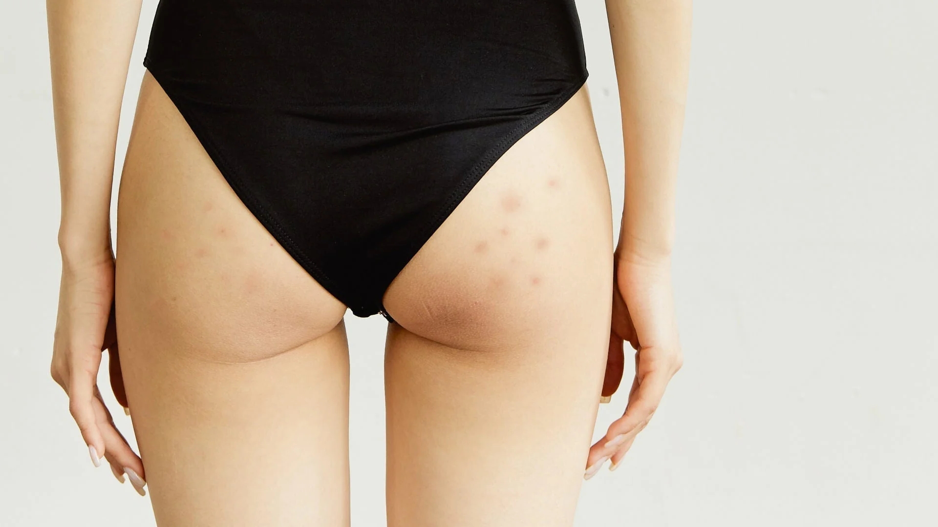 Khi lớp tế bào sừng già tích tụ lâu ngày trên bề mặt da, da có thể trở nên xỉn màu và kém mịn màng