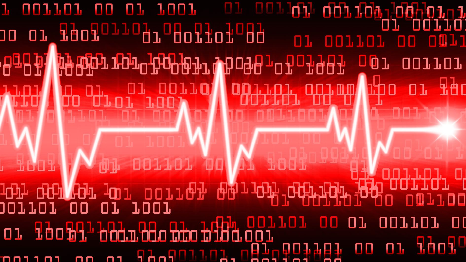 Rối loạn nhịp tim khiến người bệnh dễ gặp tình trạng khó thở sau khi ăn