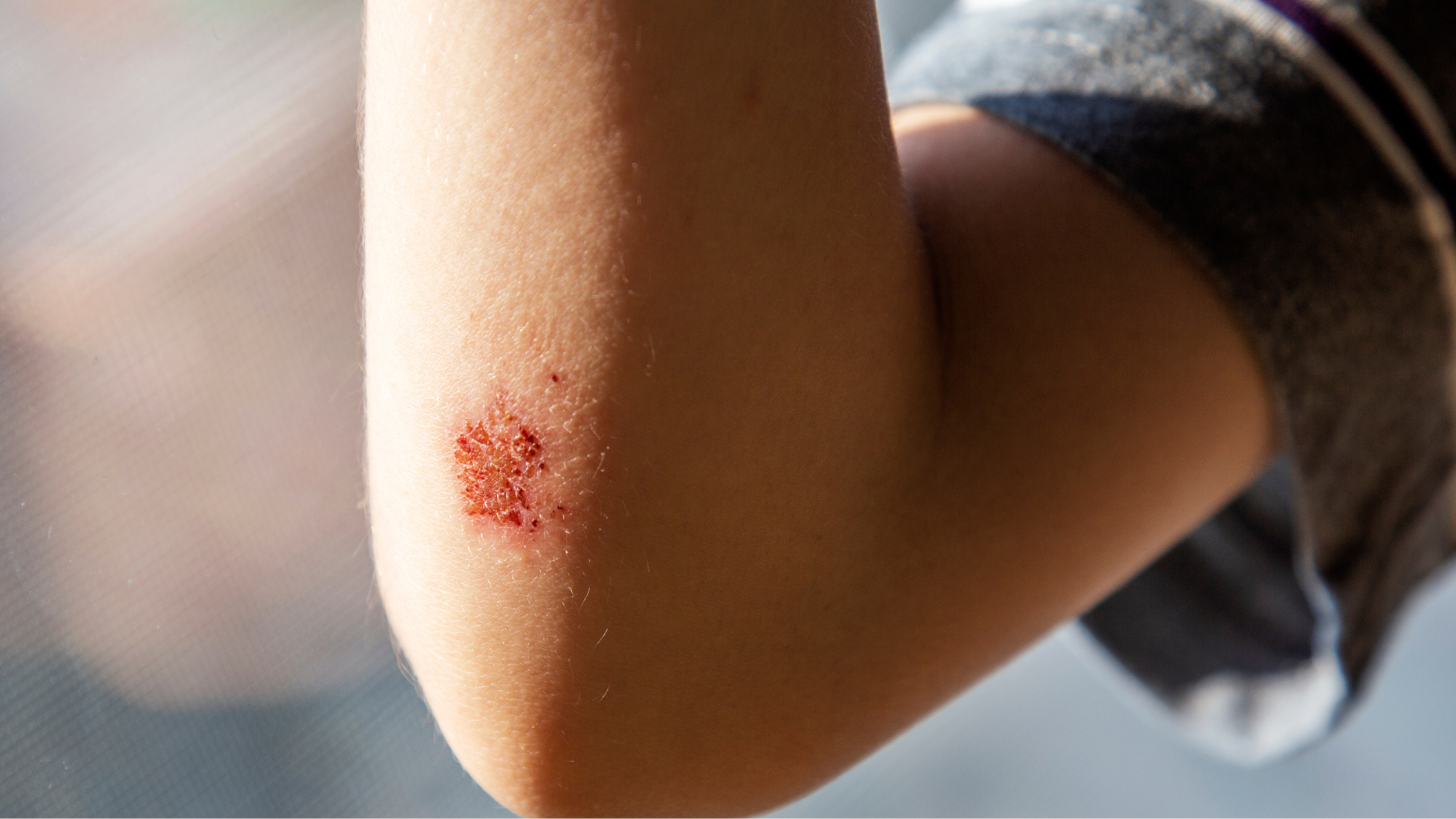 nguyen-nhan-nhiem-hpv-nao-pho-bien-bien-phap-phong-ngua-hieu-qua (1).png