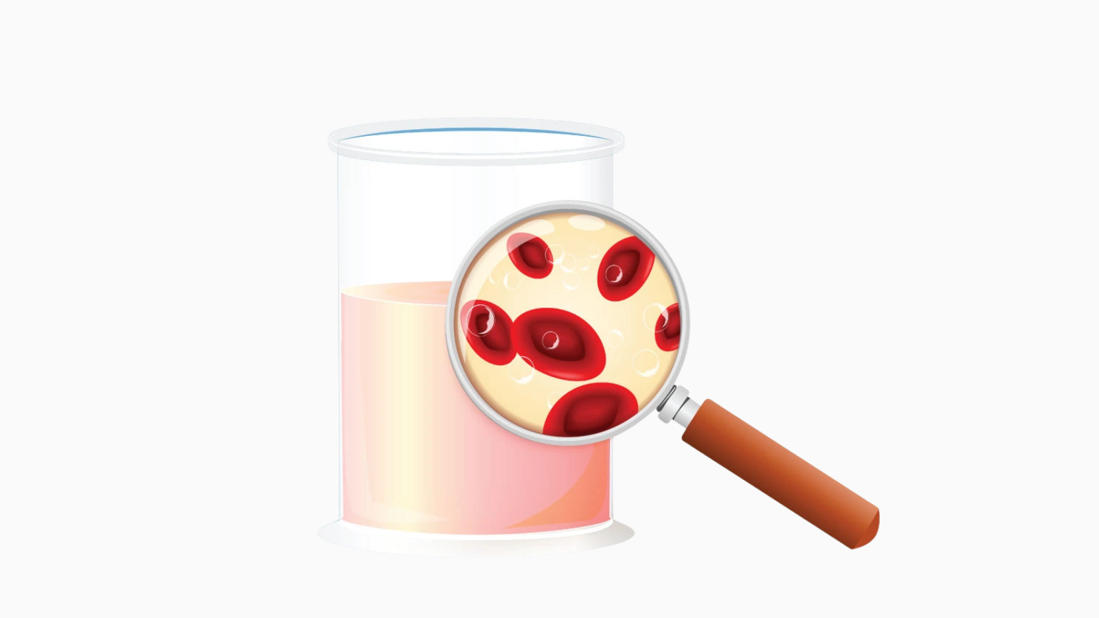 Đi tiểu ra máu nhưng không đau​ khiến nhiều người lo lắng